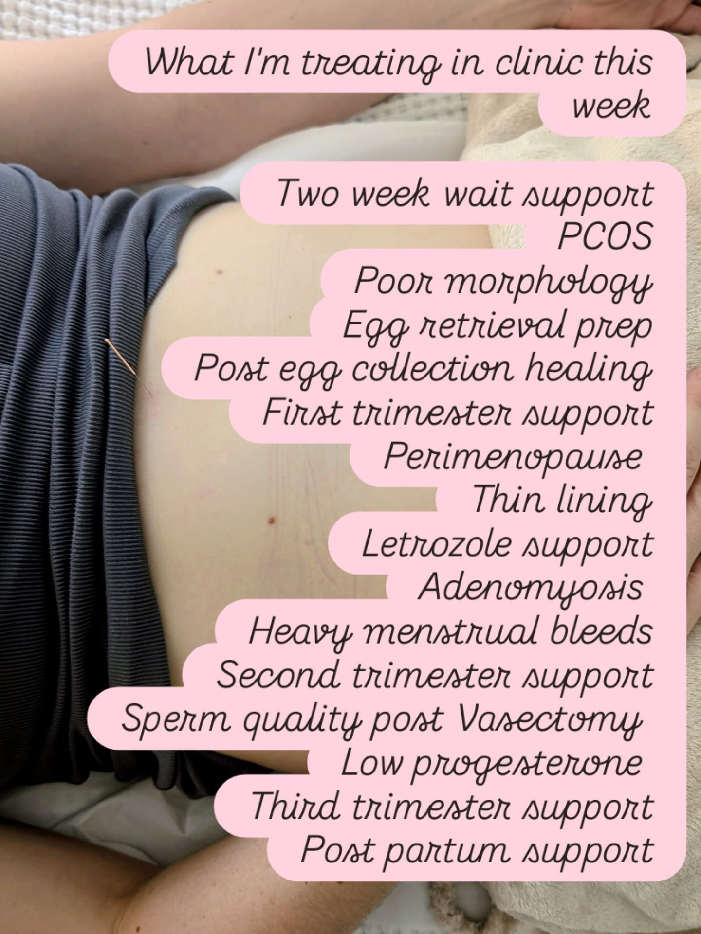 A busy clinic inside the treatment room and outside too with a diary filled with lab support calls, interpreting scrotal ultrasound results and mapping out next steps, reviewing cycle day 3 bloods, writing referrals to a trusted herbalist — plus some half term time off.
Being a fertility acupuncturist goes way beyond working with incredible needles.
It’s translating complex results into clear, manageable next steps.
It’s collaborating with other practitioners so your care feels joined-up and supportive.
If you’re in the thick of appointments, results, or simply trying to make sense of it all, know that you don’t have to navigate it alone 🤍
Link is in the bio to arrange a free discovery call x
#fertilitysupporttrained #acupuncturenorthwest #acupunctureandivf #tryingtogetpregnant #ivfwarrior