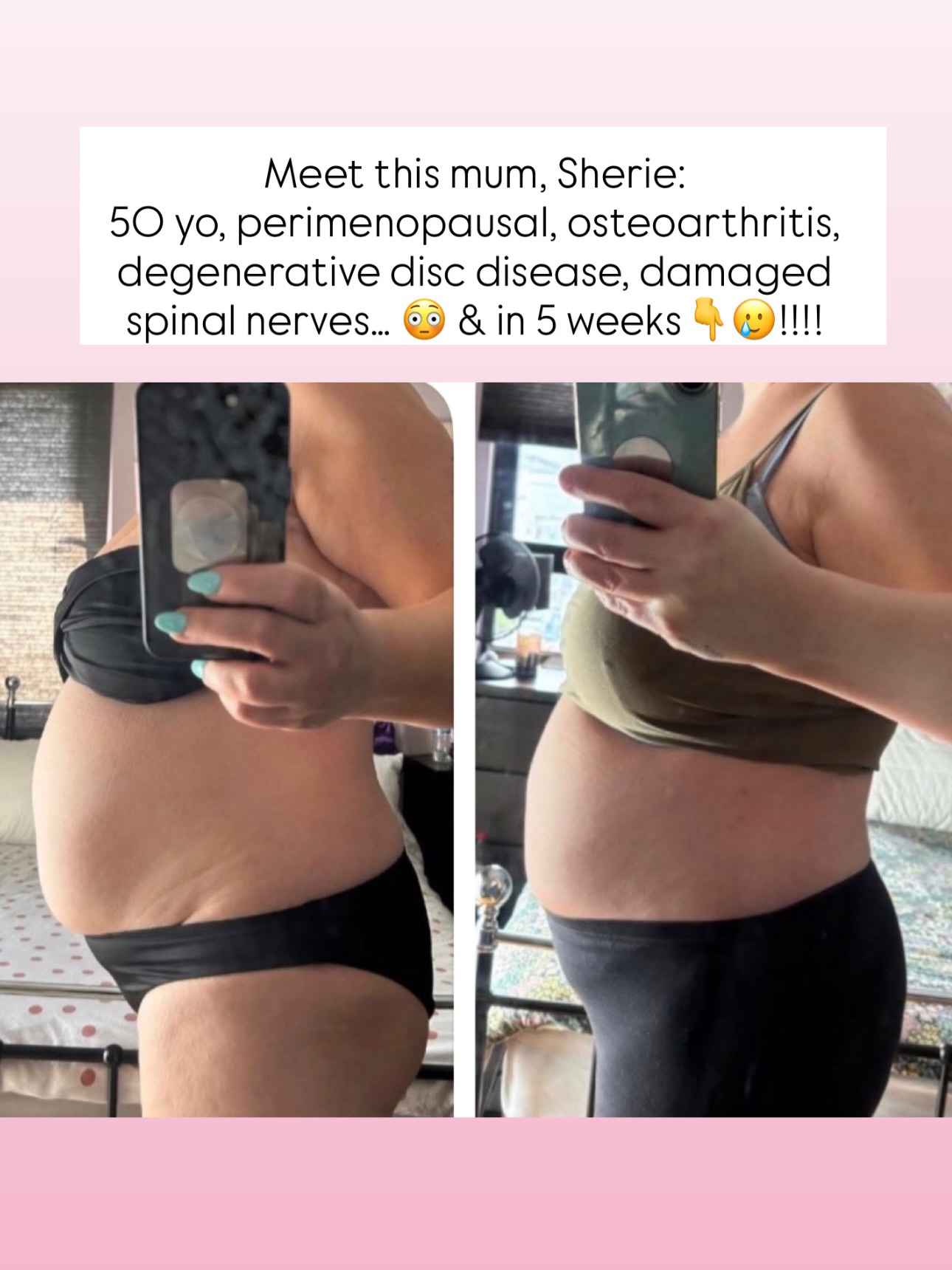 What a trooper 🏆👊….
Sherie is just putting us all to shame showing us what’s actually POSSIBLE when you try 😅👊
I mean at 50 years old, struggling with hormones and mobility issues, Sherie is totally smashing it 🔥
Sherie has gained weight due to her health issues and really wanted to work on this to reduce her aches and pains, as well as build strength - and she’s done both ! 🎉
She’s not making excuses.. She understands that small steps are necessary and she’s not quitting when it gets hard…
The Core Builder allows me to give that extra bit of accountability and support to help keep you on track, and the program brings very safe, very suitable and very serious exercise which work in harmony with your body 🩷
The program is a game changer for musculoskeletal issues and you’ll find the exercises are also used widely for rehabilitation purposes 👏
She’s been a website member for a few years and dipped in and out of the workouts, but this has really clicked and laid those foundations her body needed to build on.
You can’t build a house without the foundations hey?! 🙌
Again I’m just feeling lucky that she chose me 🥹🙏… she’s a lover of my recipes, uses my online membership and my Kate’s Kitchen recipe books 📕!
My March Core Builder so coming round quick 😳😳. Sign ups are Feb 23rd - comment if you’d like a reminder on sign up day (spaces go quick!) 😆
Head to the link in my bio for more info on the program 👀
WELL DONE BEAUTIFUL SHERIE 💖
#corestrengthening #perimenopausehealth #workoutsforwomen #katesmumfitclub #legsbumsandbubbas @marcus_costello75