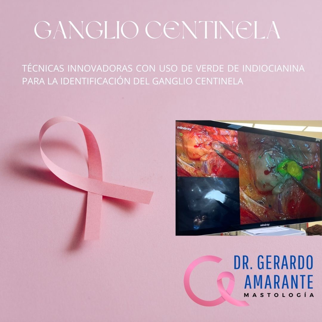 En la cirugía para tratar el cáncer de mama se debe realizar la identificación de ganglio centinela en pacientes que tienen clínicamente los ganglios negativos y así asegurar la correcta estadificación para definir el mejor tratamiento. Con las técnicas innovadoras se puede realizar la identificación del ganglio con la menor disección posible y así disminuimos las posibilidades de consecuencias en el brazo como puede ser linfedema o limitación de los movimientos de rotación del hombro.
🥼 Dr. Gerardo Amarante de Leon
📍GAMA Medicina de Alta Especialidad Col. Obispado
☎️ Citas y Whatsapp 8115552813
#mastologo #cirugiademama #cancerdemama #mastologia #cancer #mastectomia #reconstrucciondemama #cirujanoespecialistaenmama #biopsiademama #oncologia #consultademama #cirugiaoncoplastica #segundaopinion