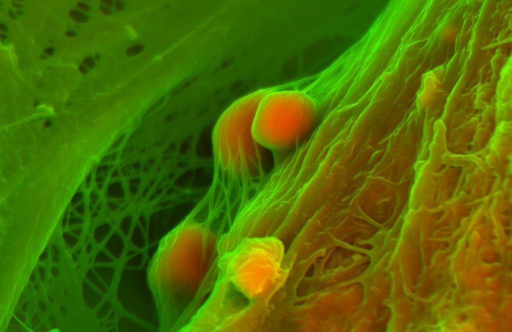Cardiac calcification
#science #electronmicroscope #laboratory #scienceart #sciencephoto #scientific #scienceweek #research #lab #micro #microscope #microscopy #medicine #medicalsciencestudent #medicalstudent #macrophotography #mineralomics #bio #biology #bioimaging #biologylab #minerals #chemistry #material #engineering #physics #sciencecommunication #ucl