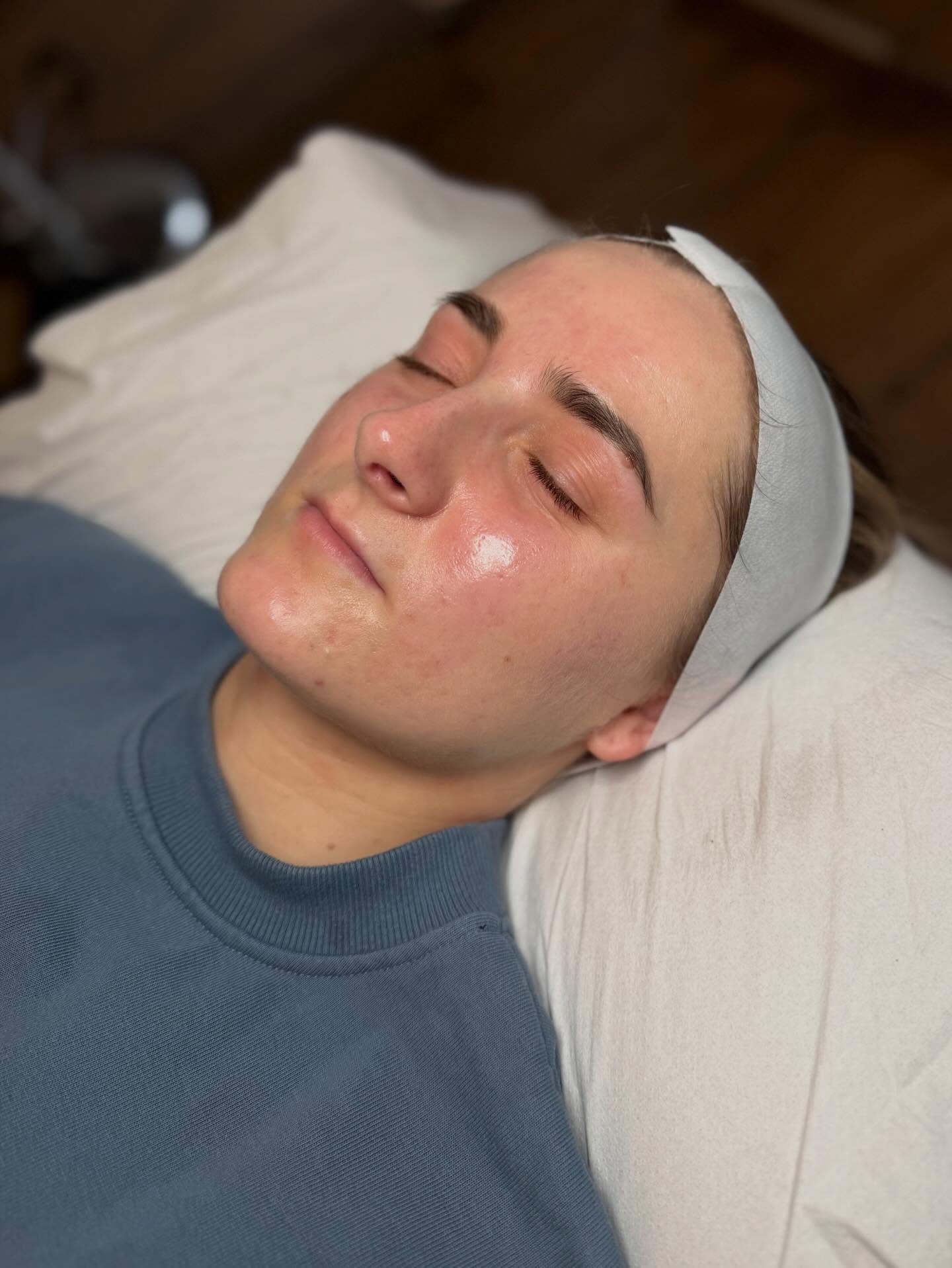 Never ceases to amaze me the absolute glow that comes from peels 🤯🤩