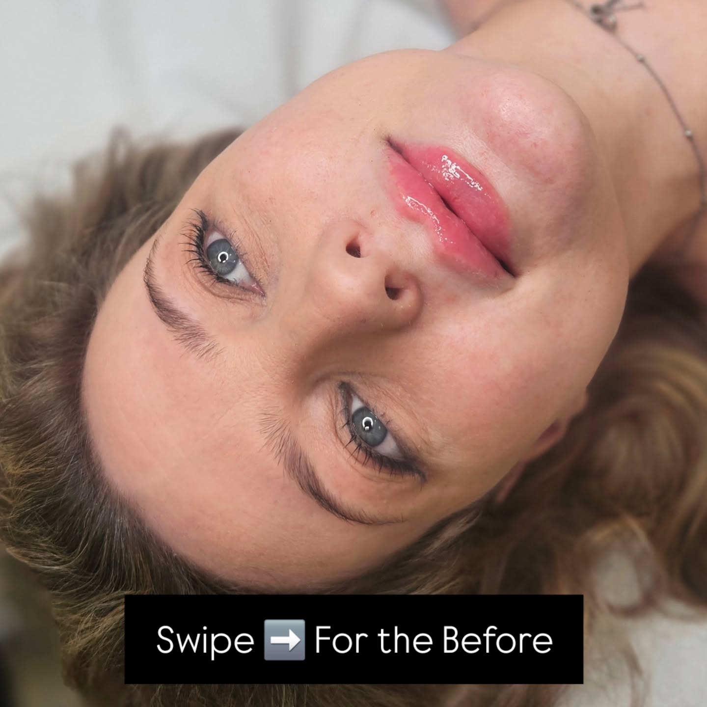 Before ➡️ After
Subtle. Balanced. Natural.
Every lip enhancement at Essex Beauty & Aesthetics starts with a full in-depth consultation — because no two lips (or faces) are the same.
We carry out a detailed lip anatomy assessment, checking:
• Lip shape & symmetry
• Natural border definition
• Volume distribution
• Muscle movement
• Facial proportions
This allows us to enhance what’s already there — not overfill or distort.
The goal?
✨ Natural results
✨ Soft structure
✨ Harmonised proportions
Lip filler should look like you… just refreshed.
DM to book your consultation 💋
#EssexBeautyAndAesthetics #essexlips#essexfillers#basildonlipfillers#basildonfillers#lipfiller#essexdermalfillers#russianlips#basildonlipfillers