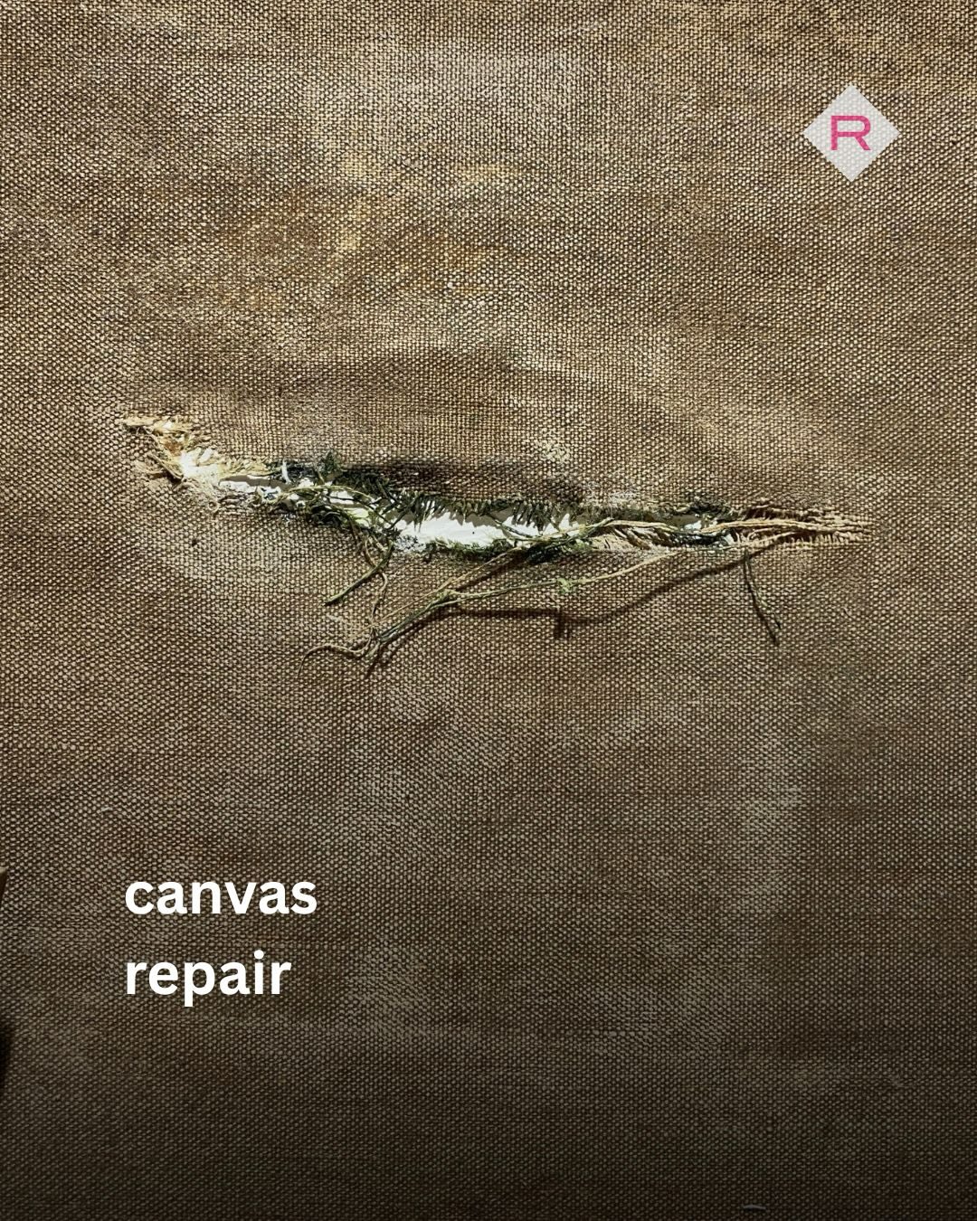 Not every restoration is about what you see at first glance. Sometimes, the most important work happens beneath the surface.
In this post, we’re sharing a canvas repair through a case study. Slide by slide, you’ll see how we carefully addressed each issue to ensure its preservation for the future.
1. Canvas repair: before any aesthetical treatment, we need to stabilize the canvas.
2. Here we can see what the loss looked like before treatment from the front of the canvas. With the help of X-ray imaging, we discovered that the damaged area had been heavily overfilled.
3. From the back, the old patch covering the loss becomes visible. You can also see how excessive the previous fill was.
4. Using controlled moisture, we carefully removed the old patch.
5. Next, we removed all the previous filling material (from both the front and back), corrected deformations, and consolidated any lifting paint to prevent further loss.
6. Once the area was clean and stable, we inserted a new piece of canvas to replace the missing section. This particular loss affected the lining canvas (not the original). We carefully interwove original threads with new ones to integrate the insert.
7. We then reattached paint flakes that were loose and we had separated to protect them during the insert adhesion. Finally, we added a second insert corresponding to the original canvas, which also performs as a patch for the previous repair.
8. After filling and retouching, you can see the before and after; a stable, secure artwork ready to continue its life.
#conservation #restoration #canvasinsert