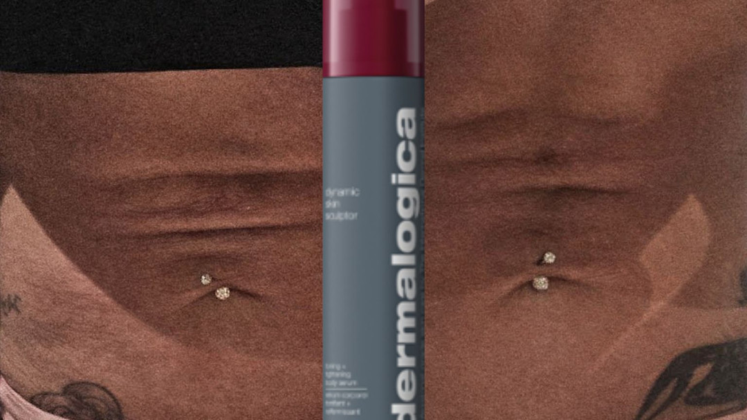 “Ozempic Face” isn’t a myth.
But it’s not what you think.
GLP-1 weight loss reduces fat.
Your face is made of fat pads.
Lose volume quickly and the structure shifts.
That can mean hollowing, shadowing, skin laxity.
This isn’t ageing overnight.
It’s architecture.
If you’re on GLP-1 — or considering it — read this before you panic… or overfill.
Read our blog = https://wix.to/WGkPFEq
#OzempicFace
#GLP1
#GLP1WeightLoss
#WeightLossJourney
#WeightLossTransformation