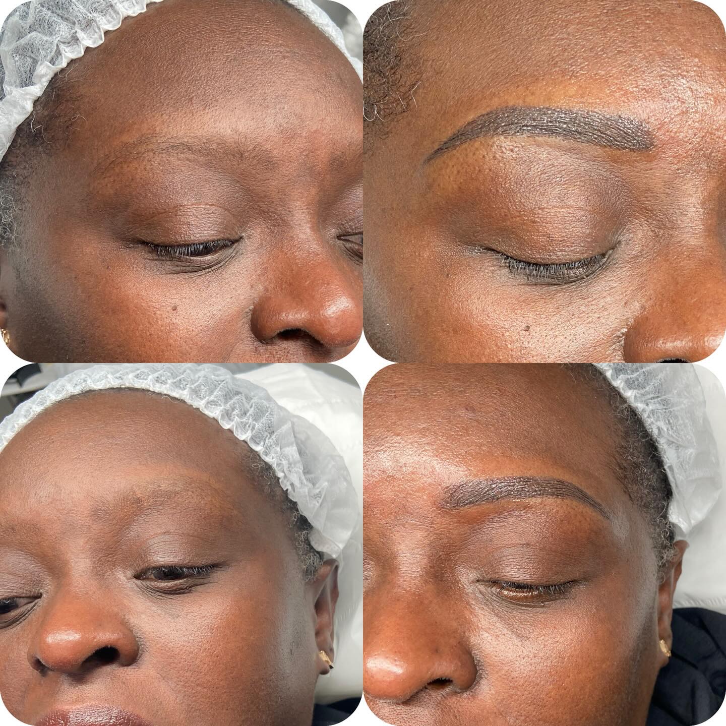 Soft, natural ombre brows that frame your face beautifully. Effortless mornings. No makeup needed.
Curious how they heal? Results are even better in person.
Book your ombre brow consultation with Naz today. β¨
Naz xx