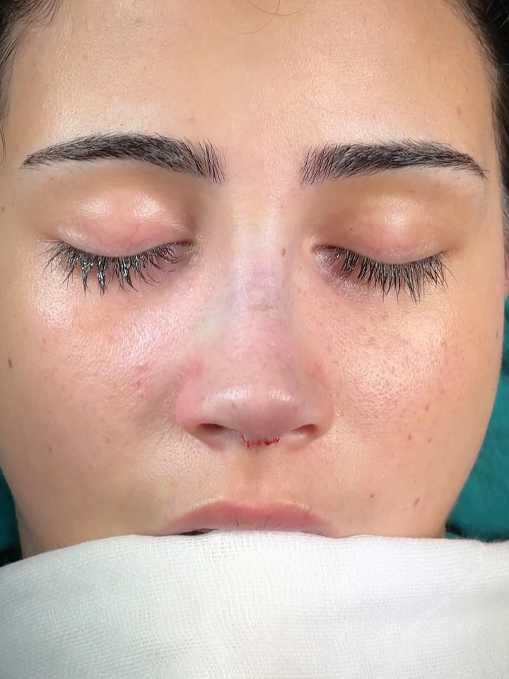 Reduction⭐️
Swipe to the end for the base view.