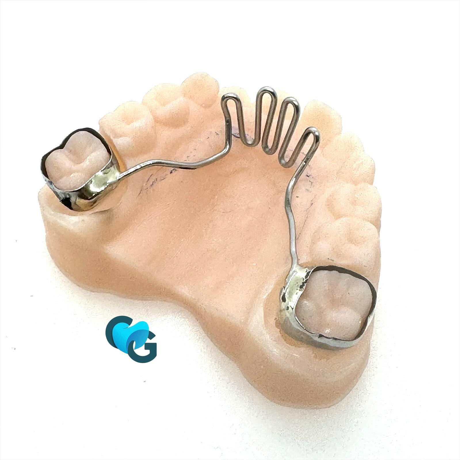 #grillantipouce #appareildentaire #appareilorthodontique #orthodontie #labordental #laboratoiredentaire #fix #dental