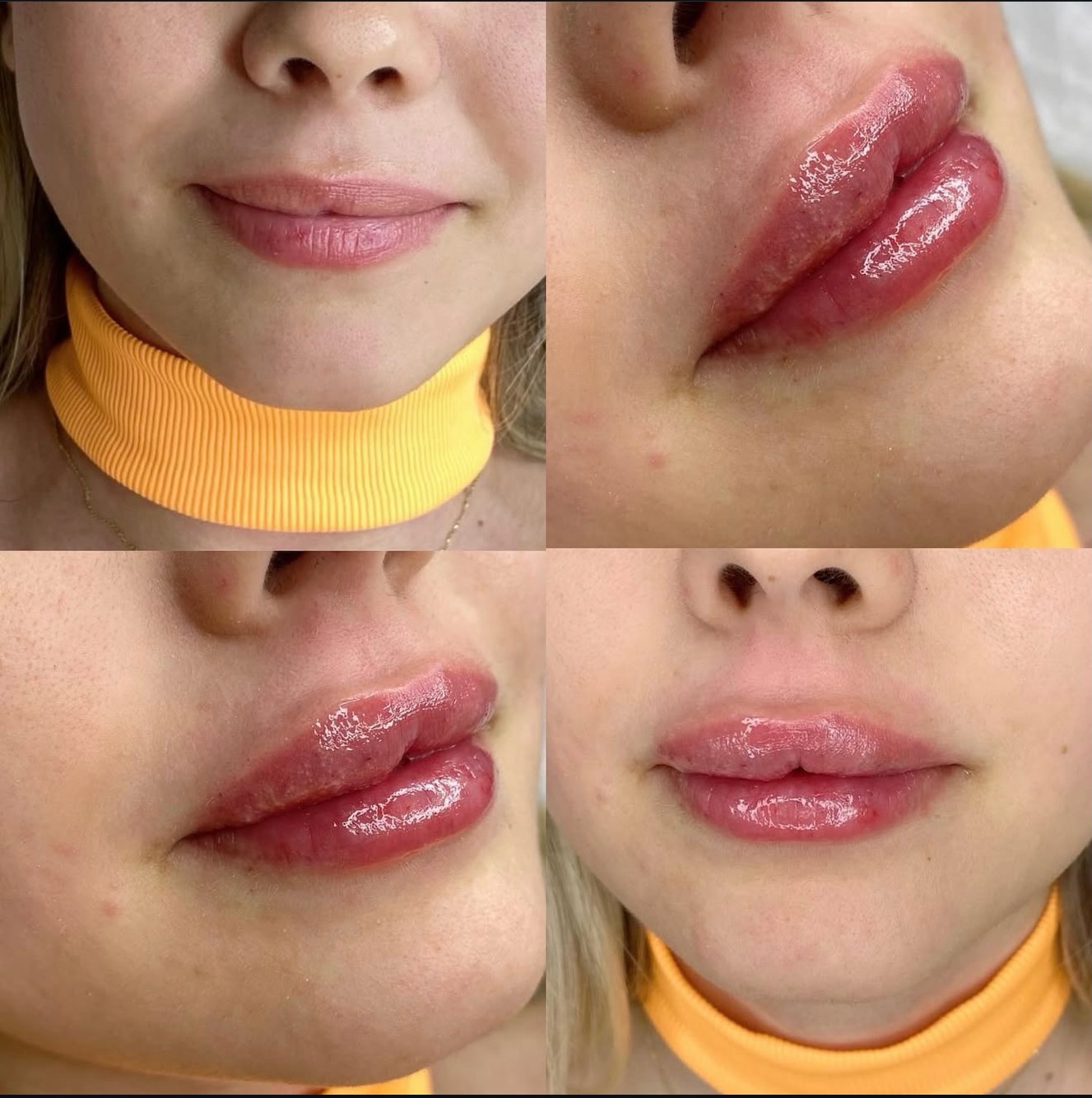 👄 detaylı bilgi ve randevu için
☎️05422267334