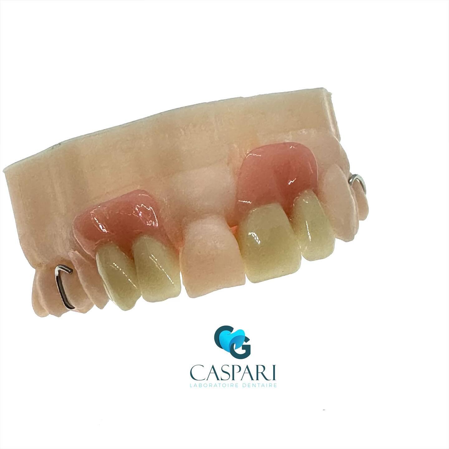 Partiel résine #prothesedentaireamovible #dentaire #resine #empreintenumerique #modelresine #formlabsdental #edentation #dent #laboratoire #dentaire #c2