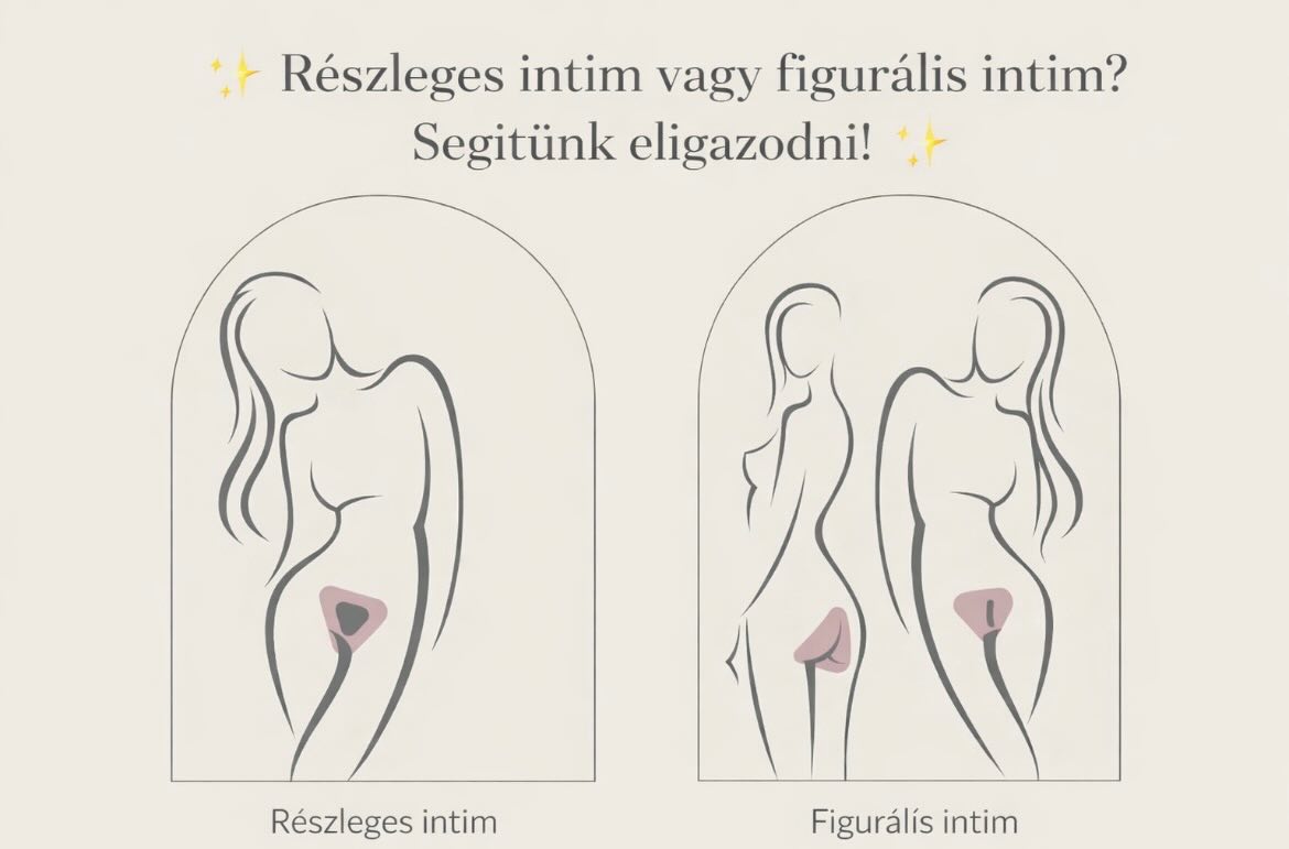 ✨ Részleges intim vagy figurális intim? Segítünk eligazodni! ✨
Hogy könnyebb legyen dönteni, összefoglaltuk a legfontosabb különbségeket 👇
🔸 Részleges intim gyanta:
Ez nem teljes intim gyantázás, hanem egy visszafogottabb, igazító kezelés, amely során a bikinivonal és az attól beljebb eső, körülbelül 2–3 ujjnyi terület szőrtelenítése történik, miközben a legérzékenyebb részek érintetlenek maradnak.
A cél egy rendezett, ápolt hatás anélkül, hogy teljes szőrtelenítés történne.
✨ Igény esetén kiegészíthető a fenék belső területének szőrtelenítésével.
👉 Kinek ajánljuk?
• első intim gyantázás előtt állóknak
• akik fokozatos megoldást keresnek
• akik természetesebb eredményt szeretnének
• akik csak esztétikus igazítást kérnek
• sporthoz, nyaraláshoz praktikus választás
🔸 Figurális intim gyanta:
Ez egy teljes intim gyantázás, azzal a különbséggel, hogy a szeméremdombon meghagyunk egy kisebb részt, amit formára alakítunk.
Lehet csík, háromszög vagy más forma mindig az adottságokhoz és az elképzelésedhez igazítva.
✨ A fenék belső területe ennél a szolgáltatásnál is kérhető.
👉 Kinek ajánljuk?
• akik teljesen sima érzetet szeretnének
• akik formázott, tudatos megjelenést választanak
• akik tartós, letisztult eredményt szeretnének
• rendszeres intim gyantázás esetén
• akik extra ápolt, magabiztos érzetre vágynak
Bizonytalan vagy? Segítünk kiválasztani a számodra legkomfortosabb megoldást 🤍
További információ:
🌐 www.bodywax.hu
✉️ info@bodywax.hu
📞 (70) 773 7060
#intimgyantázás #részlegesintim #figurálisintim #waxszalon #szőrtelenítés