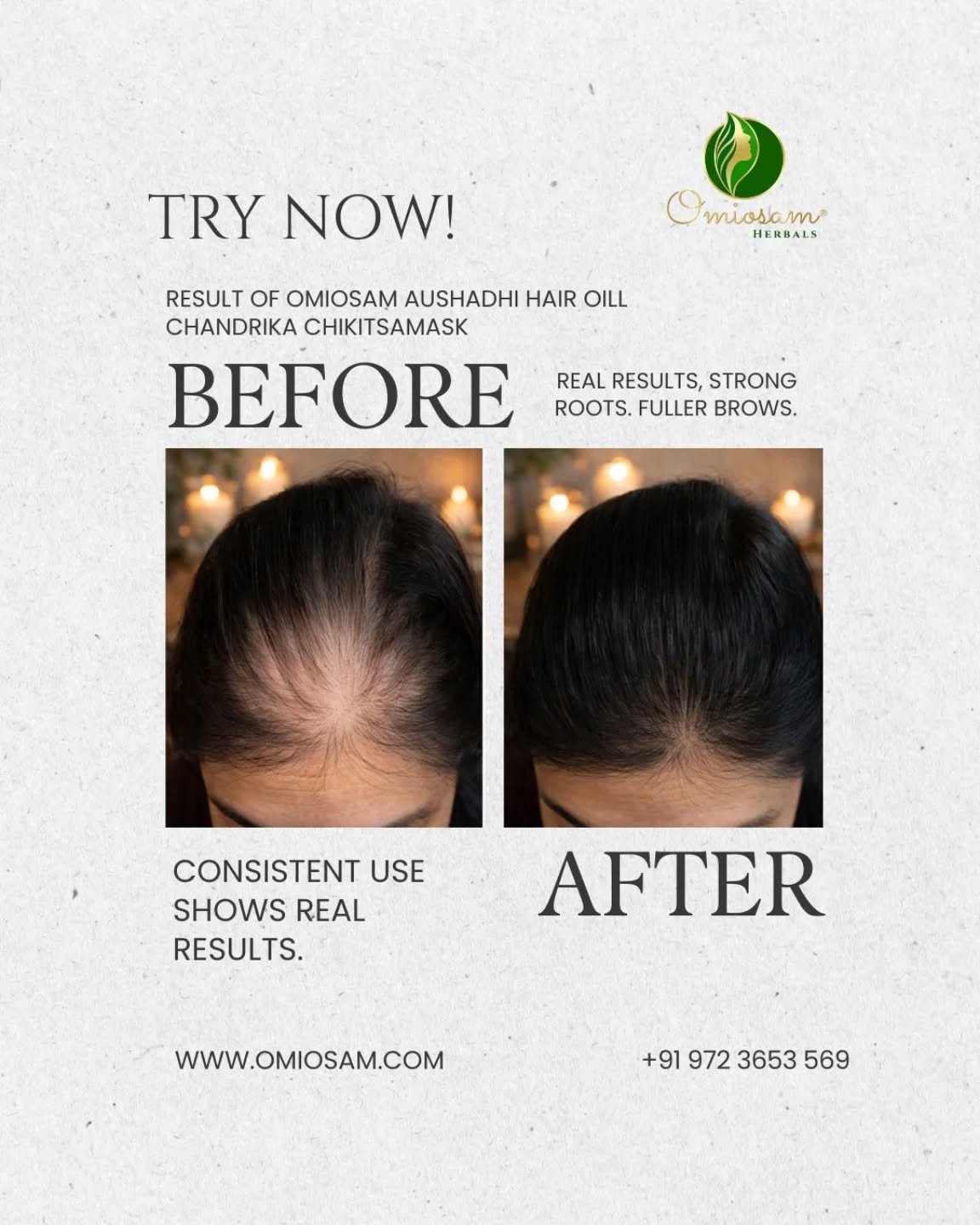 Real result of chandrika chikitsa hair mask and Aushadhi hair oil.
Millions of people got benifits of natural products in what are you waiting for?
Place order today and get 100% natural products.
Shop now
www.omiosam.com