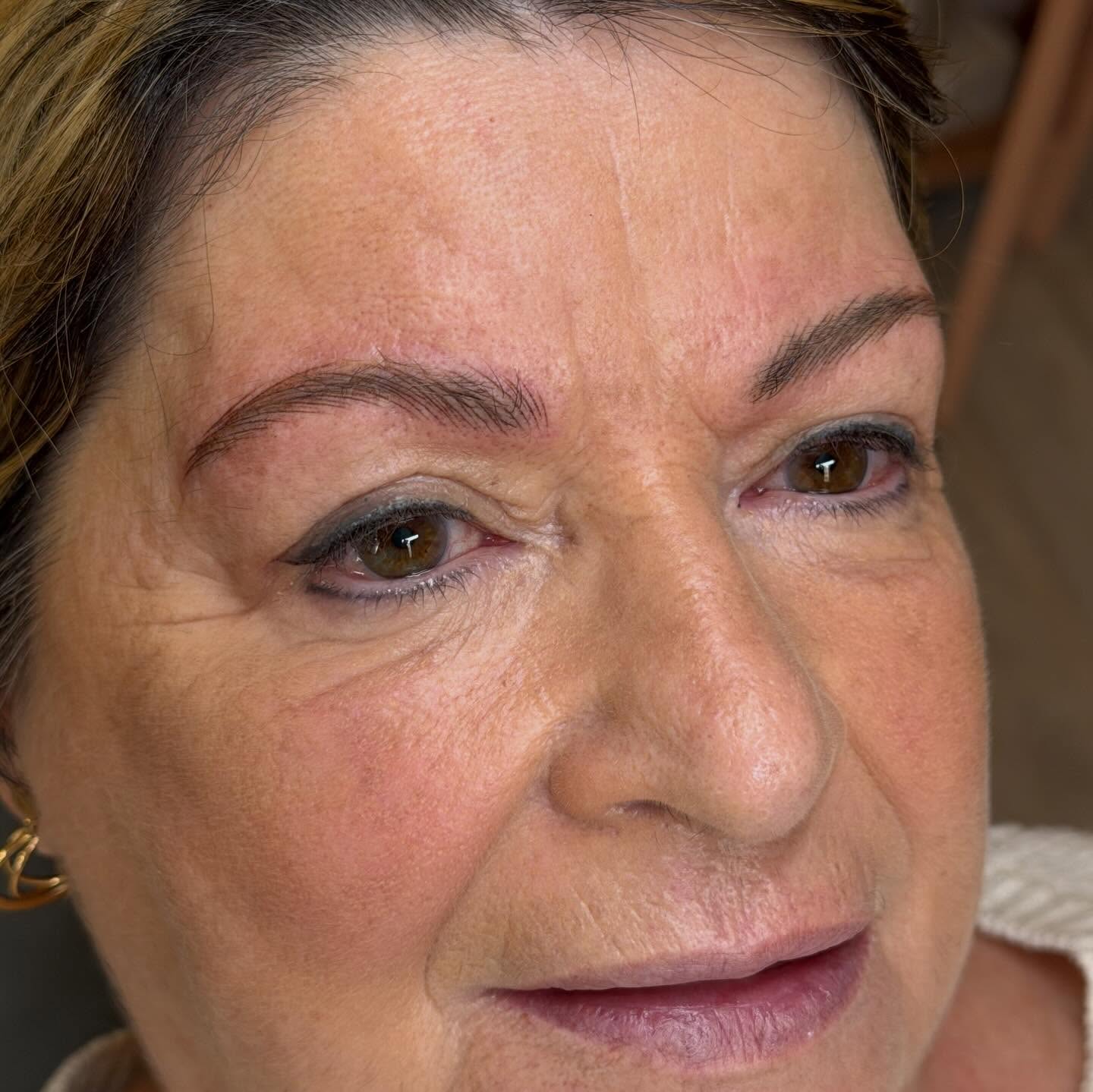 Résultat d’un rattrapage sourcils réalisé sur 6 mois. 😍
Ce travail a nécessité :
• 2 séances de détatouage laser pour tenter d’effacer l’ancien pigment
• Un temps de cicatrisation respecté entre chaque étape d’au moins 5 semaines
• Une restructuration complète
• Une technique poil à poil en maquillage permanent pour un rendu naturel et harmonieux
Chaque correction demande une analyse précise : couleur résiduelle, profondeur du pigment, état de la peau et morphologie du visage.
L’objectif n’est pas seulement d’effacer, mais de reconstruire avec justesse et élégance.
Merci à ma cliente pour sa confiance tout au long de ce protocole. J’ai conscience que ce cap est difficile à passer, qu’il vous fait peur. Mais il est nécessaire pour redonner une seconde vie à votre regard
Pour toute demande de rattrapage, un diagnostic personnalisé est indispensable ! ✨
#rattrapagesourcils #correctionsourcils #maquillagepermanentreparateur #anciensourcils #marinelaporte
