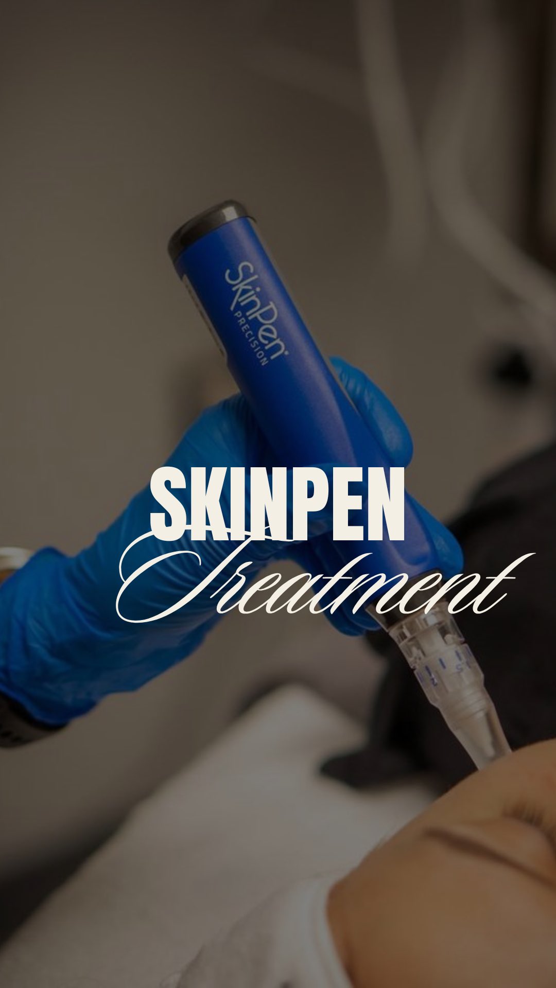 De pijn is het waard 🤌
#microneedlingdenhaag #microneedlingthehague #skinpennederland #skinpendenhaag #zalmdna