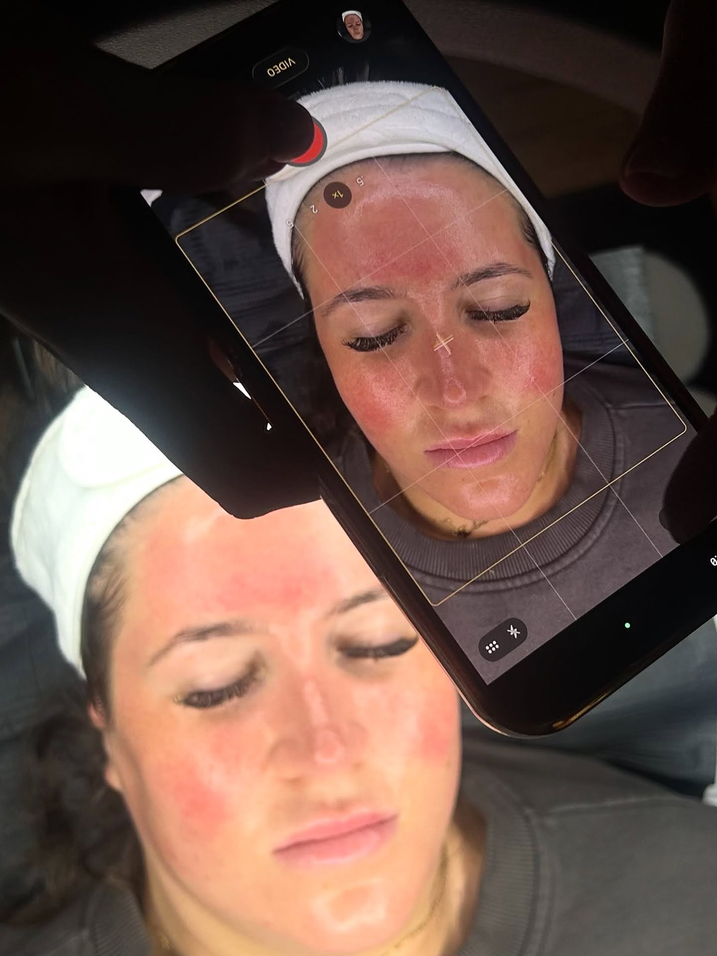 That post-facial glow hits different ✨
Fresh, hydrated, and radiant from within 🤍
If you needed a sign to book a facial - this is it💌
#facial #skinglow #skincare #aesthetics #sunderland