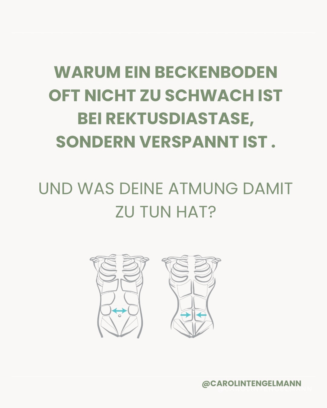 Ein verspannter Beckenboden ist nicht automatisch ein starker Beckenboden.
Oft ist er ein Muskel, der zu lange zu viel kompensieren musste. Bei Gegenatmung fehlt dem System
eine gleichmäßige Druckverteilung. Fu weißt nicht was das ist? Schau in unser Highlight Atmung, da findest du einen Test.
Der Bauch kann nicht reagieren.
Der Beckenboden springt ein.
Und bleibt im Dauerjob.
Das Ergebnis fühlt sich oft an wie:
• Druck
• Ziehen
• Instabilität trotz Training
• fehlende Kontrolle
Mehr Anspannung ist hier nicht die Lösung.
Sondern bessere Abstimmung.
🤍 Speichern, wenn du das Thema neu sehen darfst.
🤍 Folge mir, wenn du deinen Körper ganzheitlich verstehen willst.