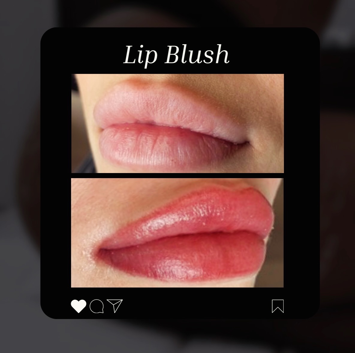 Don’t miss our $350 Lip Special for the month of February.
Includes initial and touchup session.
Book in the month of February for any available or future date. Sale ends February 28th. ($100 savings; regular price $450)
BEATANDBLADE.COM
(832) 377-5677
info@beatandblade.com
#lips #lipblush #liptattoo #lipneutralization #ootd
