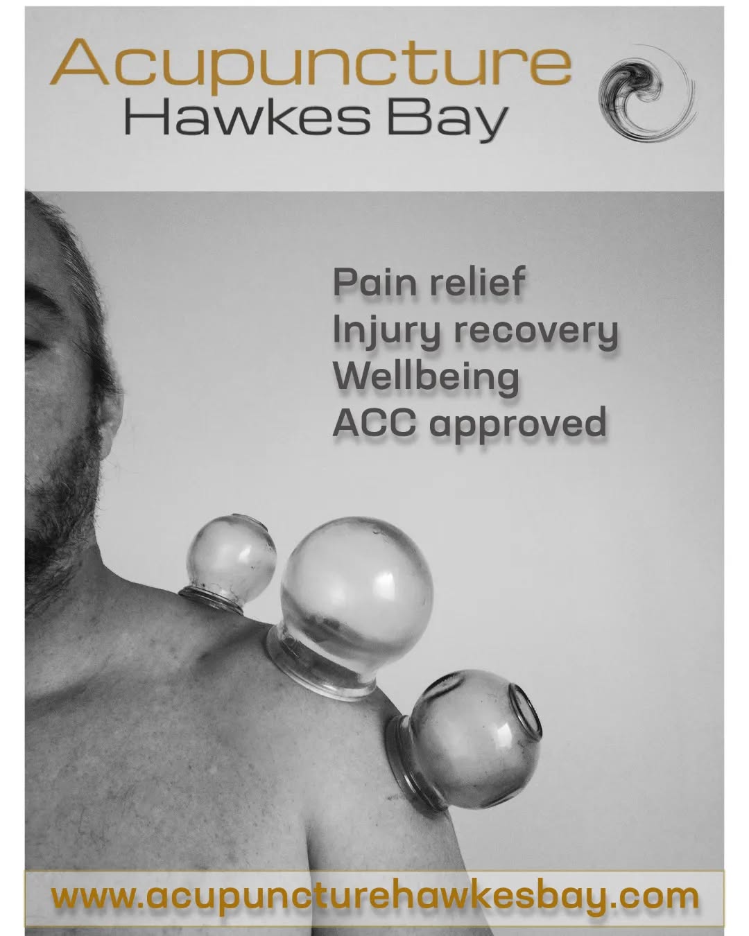 #acupuncturehawkesbay #acupuncture #acupuncturenz