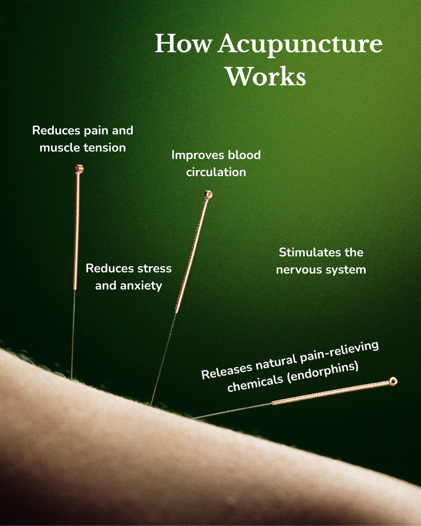 Acupuncture gently stimulates the nervous system to support circulation, release natural pain-relieving chemicals, and guide the body into a calmer, restorative state. Many people notice better sleep, less tension, and improved balance.
At Laya, your Initial Acupuncture Assessment looks beyond symptoms. Our Registered TCM Practitioner takes the time to understand your health history and create a treatment plan tailored to you.
If you’ve been feeling out of balance, this is a powerful place to begin.
Book your Initial Acupuncture Assessment at Laya Spa & Yoga. 🌿