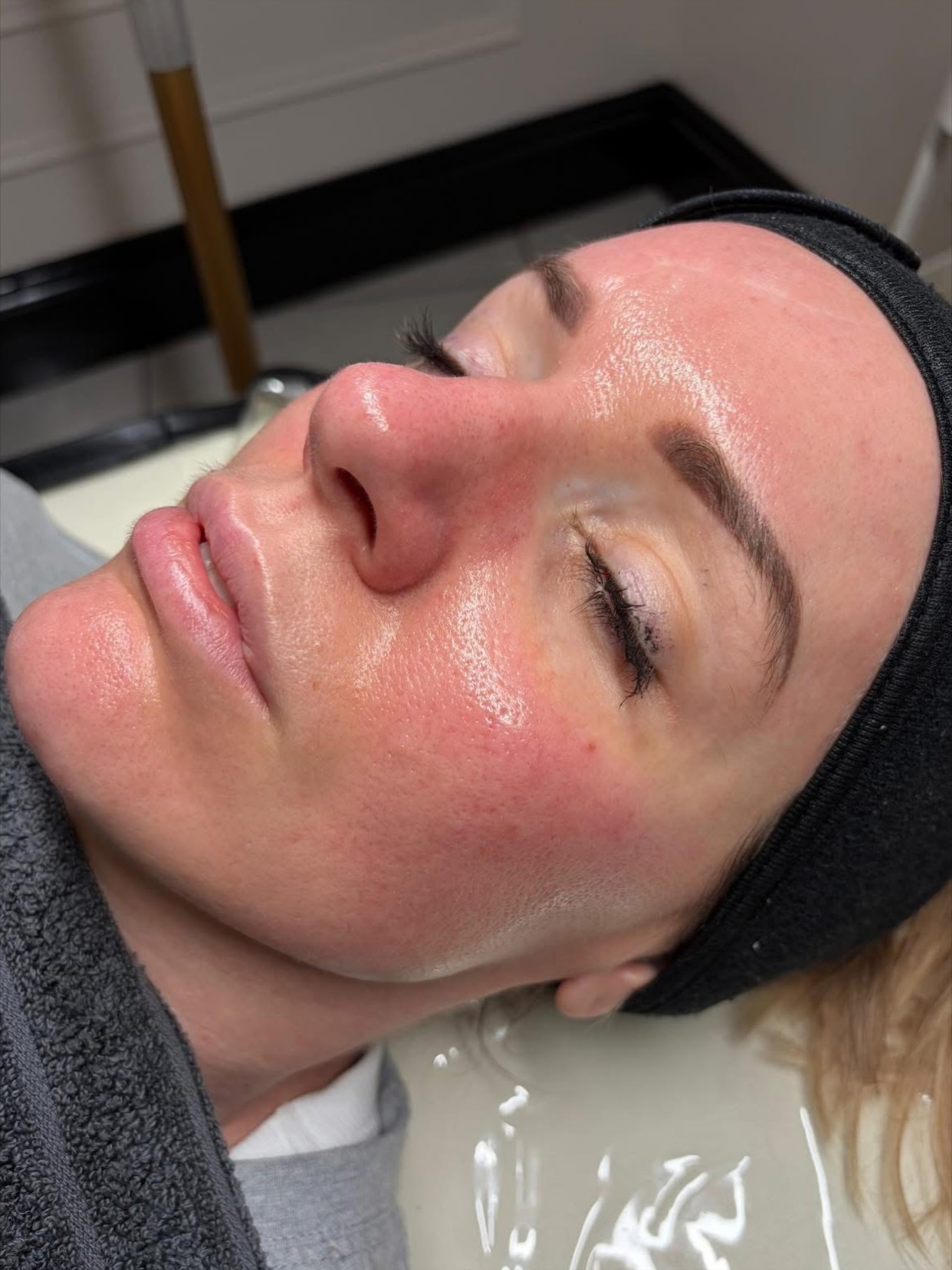 ✨ Hydrafacial Results – No Filters. No Makeup. Just Skin. ✨
Zoom in.
This is what happens when we deeply cleanse, exfoliate, extract and infuse the skin with medical-grade hydration in one treatment.
💧 Removes congestion
💧 Clears blocked pores
💧 Lifts dull, tired skin
💧 Instantly boosts hydration
💧 Smooths texture
💧 Gives that “glass skin” glow
And the best part?
There’s no downtime. You walk out glowing.
If your skin feels:
– rough
– congested
– dry
– uneven
– tired
– makeup sitting badly
This is your reset button.
Most people waste months trying new products when one professional treatment can completely rebalance the skin barrier in under an hour.
Hydrafacials are:
£45 standard
£25 on pre-booked model days
Model days always go first because they’re limited and once they’re gone… they’re gone.
If you’ve been waiting for a sign to sort your skin before spring hits properly… this is it.
Comment GLOW or message me to secure your slot before the model list fills up 🤍✨