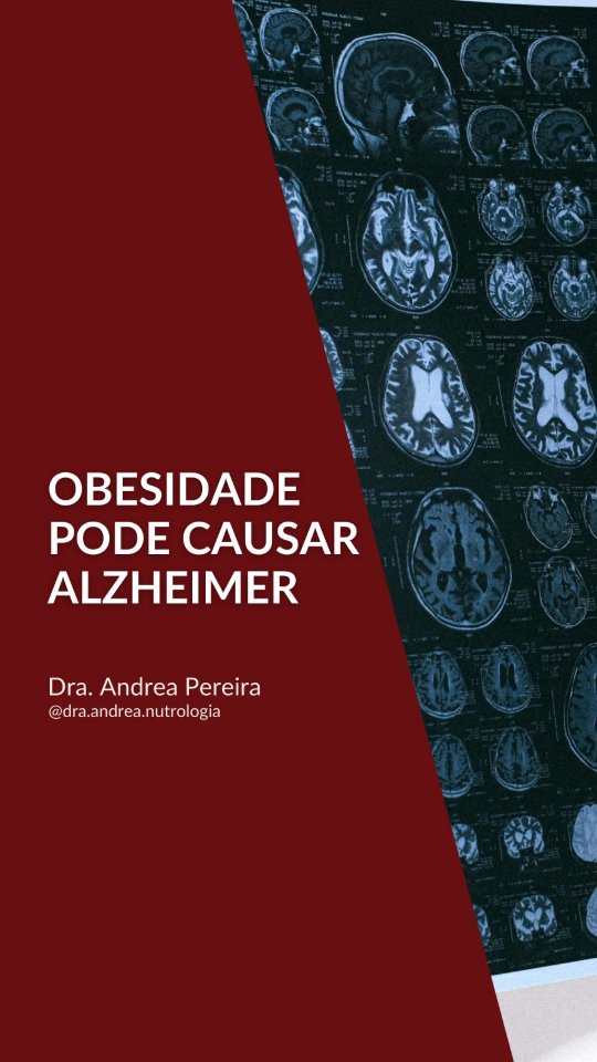 Você sabia que existe uma associação entre obesidade e demências?
A obesidade não impacta apenas o coração e o metabolismo. Ela também pode afetar a saúde do cérebro.
Cuidar do peso corporal, da alimentação, da qualidade do sono e manter acompanhamento médico são estratégias fundamentais para prevenção a longo prazo.
Nesse vídeo explico por que essa associação acontece.
Assista ao vídeo completo no YouTube (Dra Andrea Pereira Nutrologia).