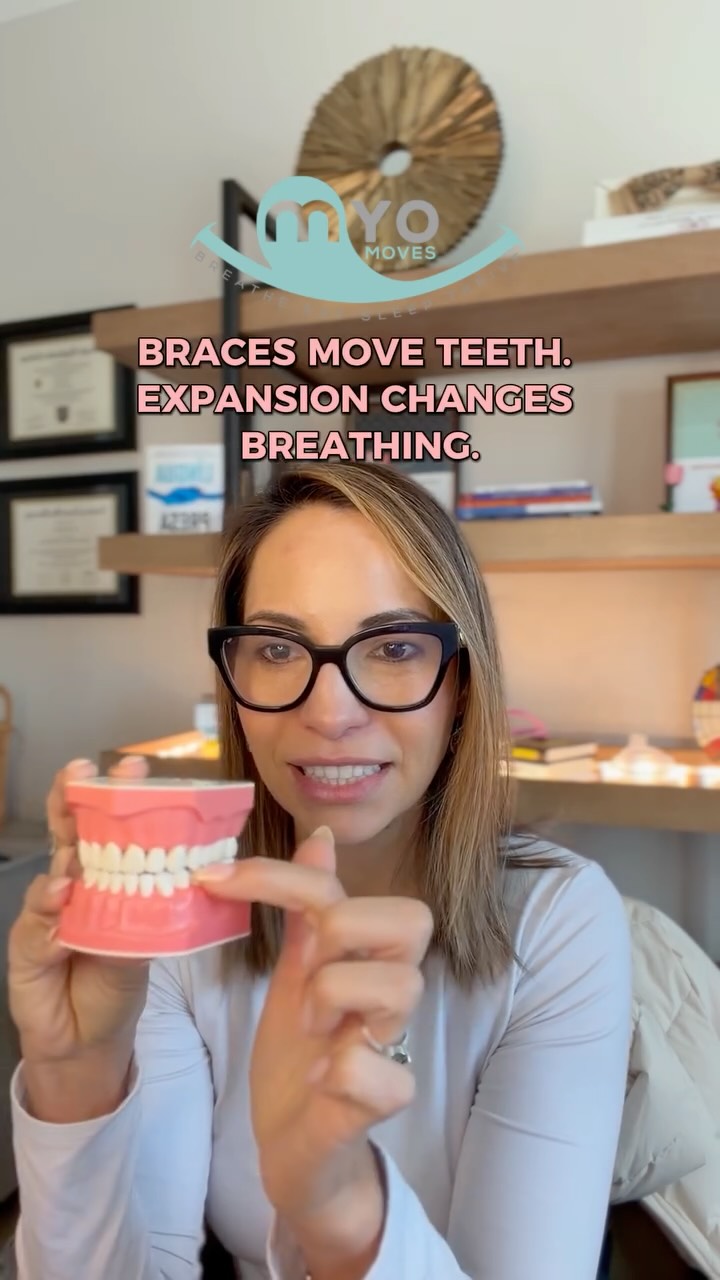 When the top teeth sit almost edge-to-edge with the bottom teeth, that usually means the upper jaw might be narrow. Braces and Invisalign are amazing at moving teeth. They can tip teeth outward within the bone to create space and sometimes that’s all someone needs.
But if the foundation (the upper jaw) is narrow? That’s a different conversation. Because the upper jaw also forms the floor of the nose. So when we expand the bone itself, not just tip the teeth, we’re often:
• Creating real space for the tongue
• Supporting better nasal breathing
• Improving long-term stability
If teeth are simply pushed outward within a narrow foundation, they’re more likely to relapse. Teeth follow the bone. And the tongue follows the space.
Not every patient needs skeletal expansion, but if breathing, nasal congestion, or crowding are part of the story—it’s worth asking deeper questions to build the right foundation!
💬 Comment “expandme” to learn more about palatal expansion.
#PalatalExpansion #AirwayHealth #AirwayOrthodontics #BreatheBetter #myofunctionaltherapy