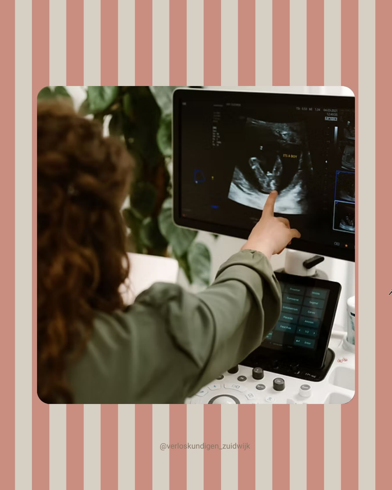 💙 Duidelijk een jongetje!
Tijdens de geslachtsecho die we binnen onze eigen praktijk uitvoeren kunnen we zien of jullie een jongen of meisje verwachten. Willen jullie het meteen weten? Dan vertellen we het natuurlijk direct. Liever zelf het grote moment plannen? Dan geven we het geslacht ook in een gesloten envelop mee ✉️
#echo #geslachtsecho #verloskundigen