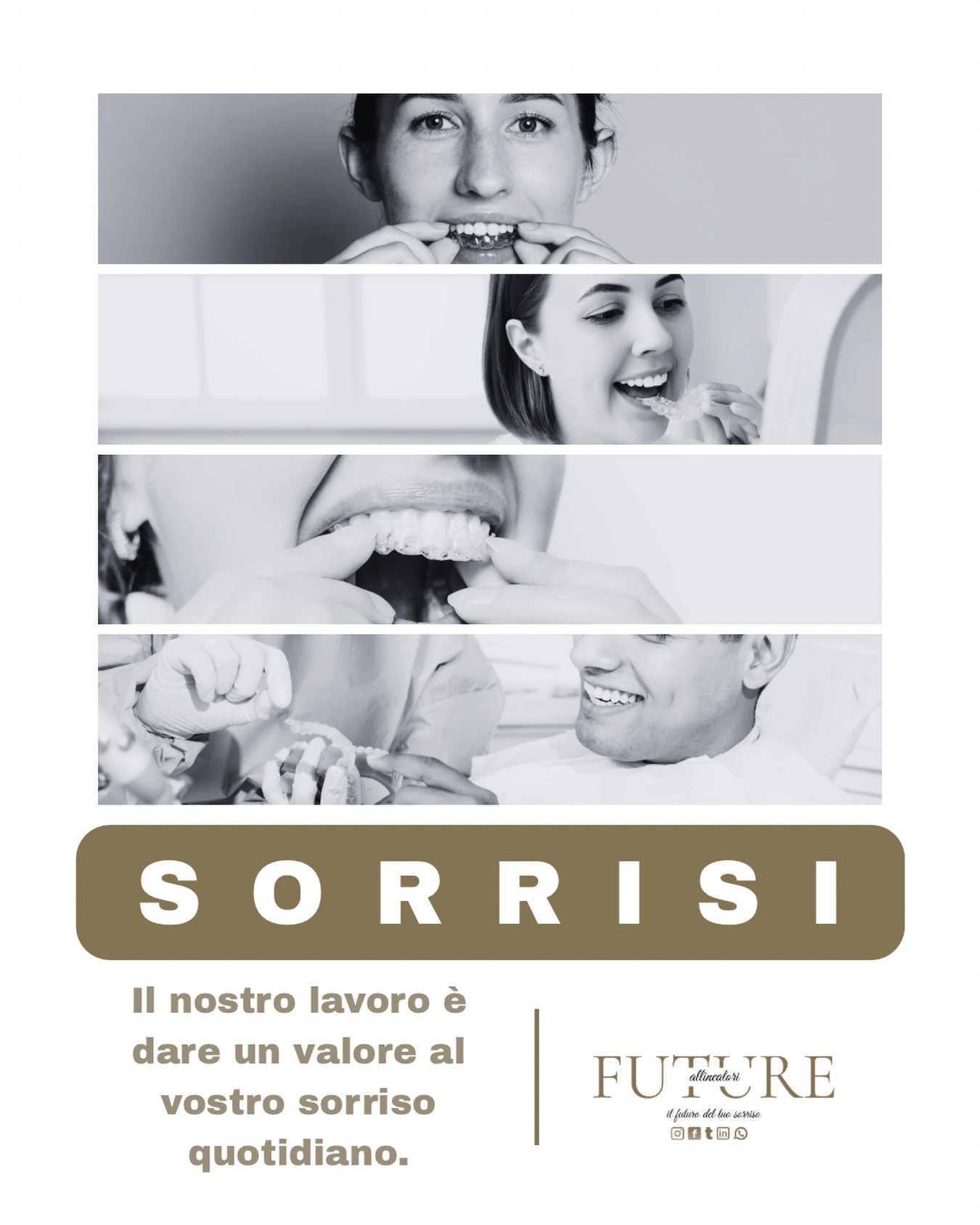𝗦𝗢𝗥𝗥𝗜𝗦𝗜.
Dietro ogni trattamento con allineatori trasparenti c’è molto più di un semplice dispositivo.
C’è studio del caso.
C’è pianificazione digitale.
C’è controllo delle forze.
C’è precisione produttiva.
In Future Allineatori ogni sorriso viene progettato con un approccio tecnico e strutturato, per garantire risultati prevedibili, funzionali ed estetici.
Il nostro obiettivo non è solo allineare i denti,
ma ottimizzare tempi, comunicazione e qualità del lavoro per il professionista.
𝗣𝗿𝗲𝗰𝗶𝘀𝗶𝗼𝗻𝗲.
𝗔𝗳𝗳𝗶𝗱𝗮𝗯𝗶𝗹𝗶𝘁𝗮̀.
𝗦𝘁𝗮𝗻𝗱𝗮𝗿𝗱 𝗮𝗹𝘁𝗶.
Questo è il metodo Future.
🌐 www.futureallineatori.it
#FutureAllineatori #AllineatoriTrasparenti #Ortodonzia #OrtodonziaDigitale #PazientiFelici