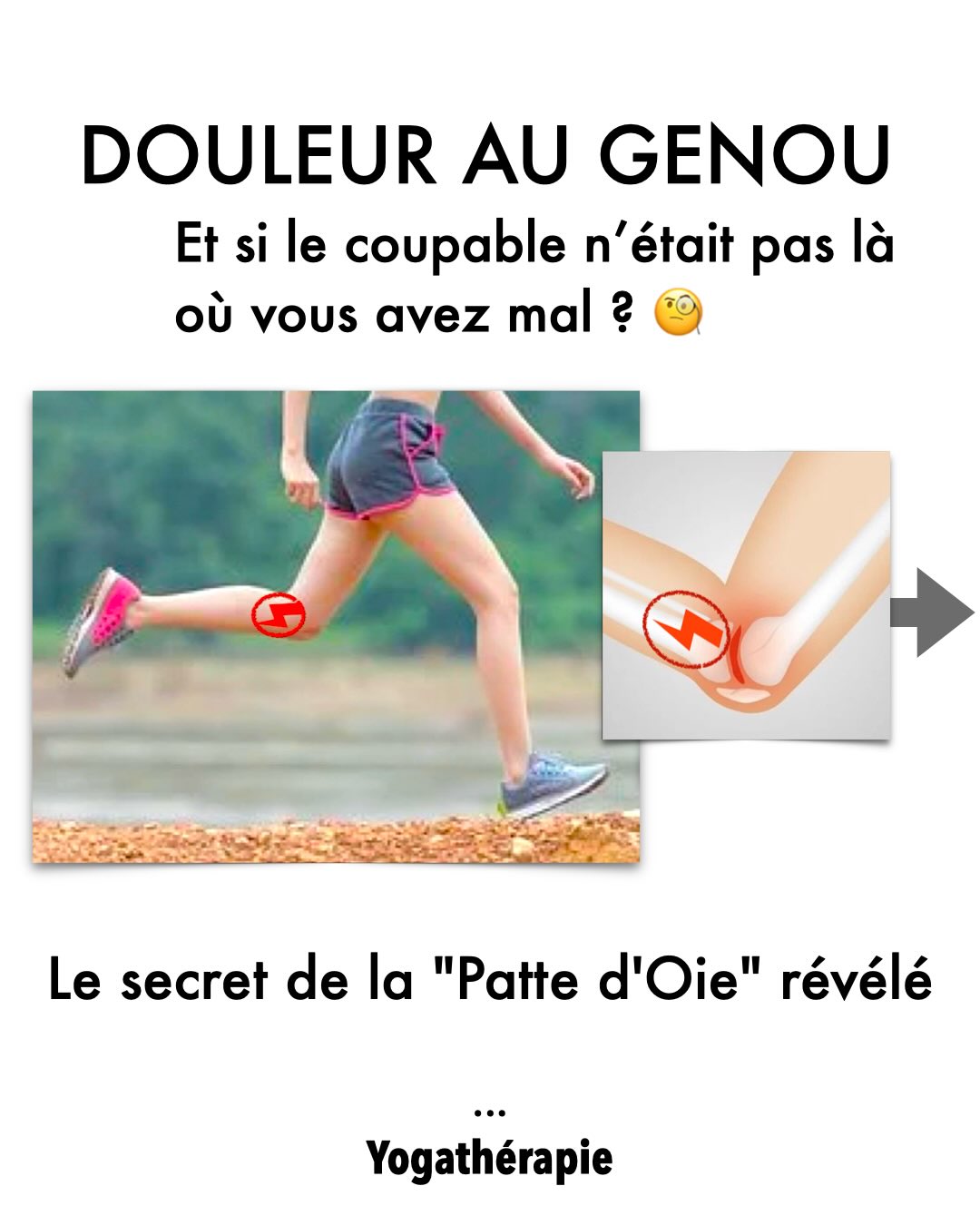 Le genou est le grand sacrifié de nos erreurs de placement 🛑
C’est souvent lui qui sert de « fusible » pour compenser un bassin verrouillé ou un pied qui s’effondre.
Résultat possible : une douleur persistante sur la face interne, ce qu’on appelle la Patte d’Oie.
Mais le genou n’est pas le coupable, il n’est que la victime de contraintes de cisaillement mécaniques. ⚙️
Dans ce carrousel, nous vous emmenons explorer ce carrefour de forces où trois muscles majeurs entrent en jeu.
Comprendre cette mécanique, c’est le premier pas pour pratiquer avec Ahimsa (non-violence) et retrouver une liberté totale de mouvement.
L’aplomb est le chaînon manquant pour ne plus subir, mais enfin comprendre l’énigme de son propre corps. 🧩💎
Envie d’aller plus loin dans l’analyse technique ?
👇 Commentez « GENOU » Je vous envoie en message privé notre article complet sur les douleurs de la patte d’oie du genou.
(Sur Facebook voir le lien en 1er commentaire)
#DouleurGenou #YogaTherapie #PattedOie #YogaAnatomy #cathetsergeyoga