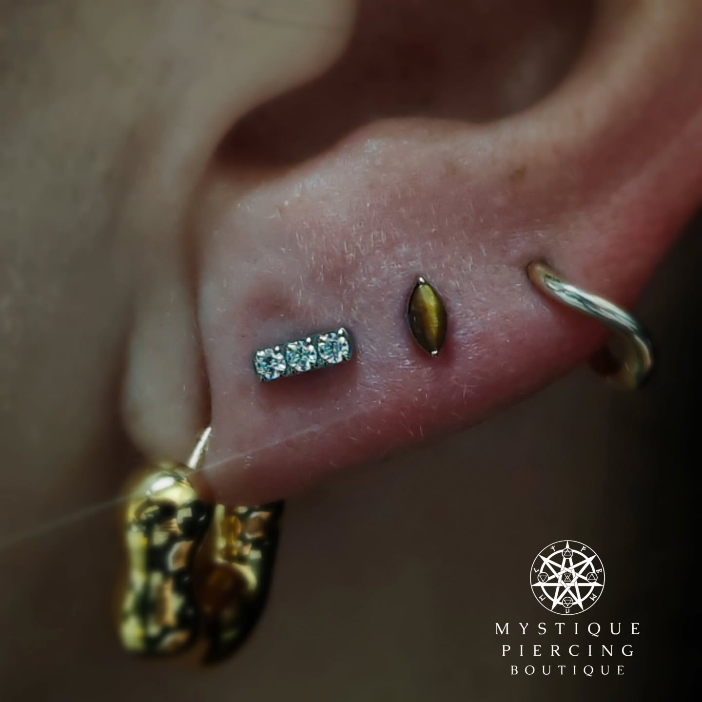 Double lobe action with @industrialstrengthuk Channel set 3 and Prong Leaf Tiger Eye from @tremunpiercing
Piercer: @symbiotic_piercing @paid2stab
Using: @probodyart @purklenz
Aftercare: @neilmedpiercingaftercare