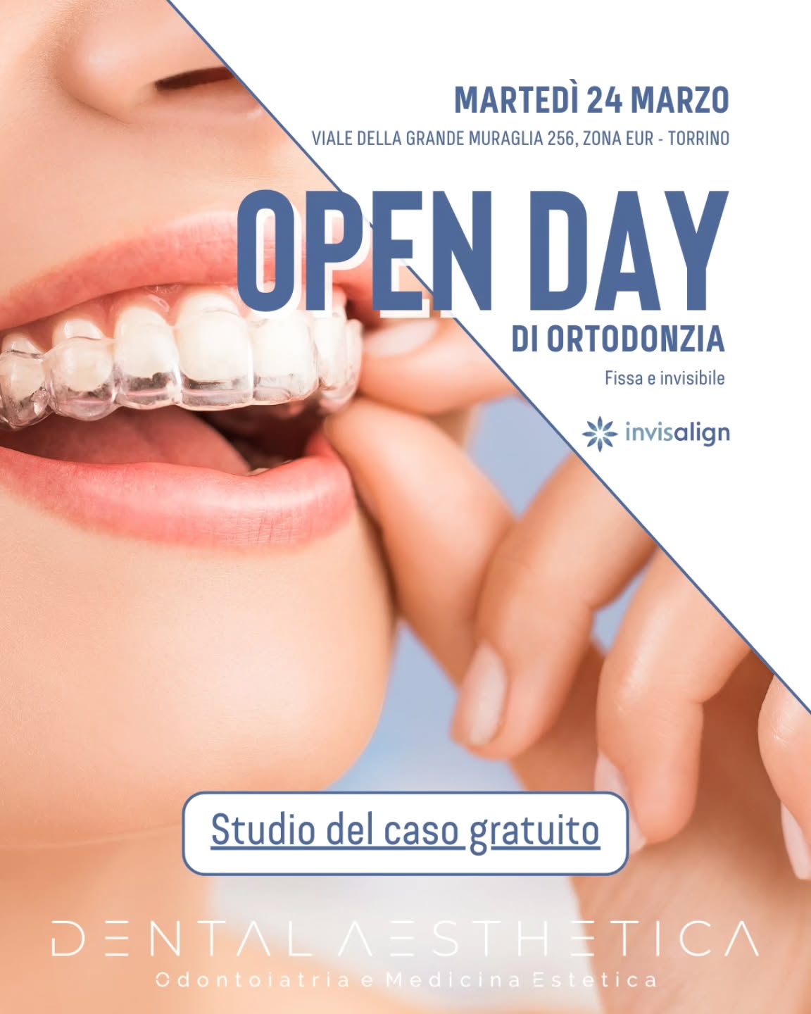 Apparecchi trasparenti per denti allineati?
🗓 Martedì 24 marzo
🦷 Open Day di ortodonzia, fissa e invisibile
I vantaggi dell'Open Day?
- Prima consulenza, ortopanoramic e studio del caso gratuiti, per un risparmio di almeno 200 euro.
Cosa faremo in visita?
- Valutazione ortodontica con la Dott.ssa Zangrillo ed esame radiologico + indicazioni personalizzate sul percorso più adatto.
Posti limitati e solo su prenotazione!
Prenota ora o invia questo post con chi sta pensando a un sorriso nuovo!
Dental Aesthetica - Odontoiatria e Medicina Estetica
📍 viale della Grande Muraglia 256, zona EUR-Torrino
📱 375 88 47 069
👩🏼⚕️ @dr.chiarazangrillo