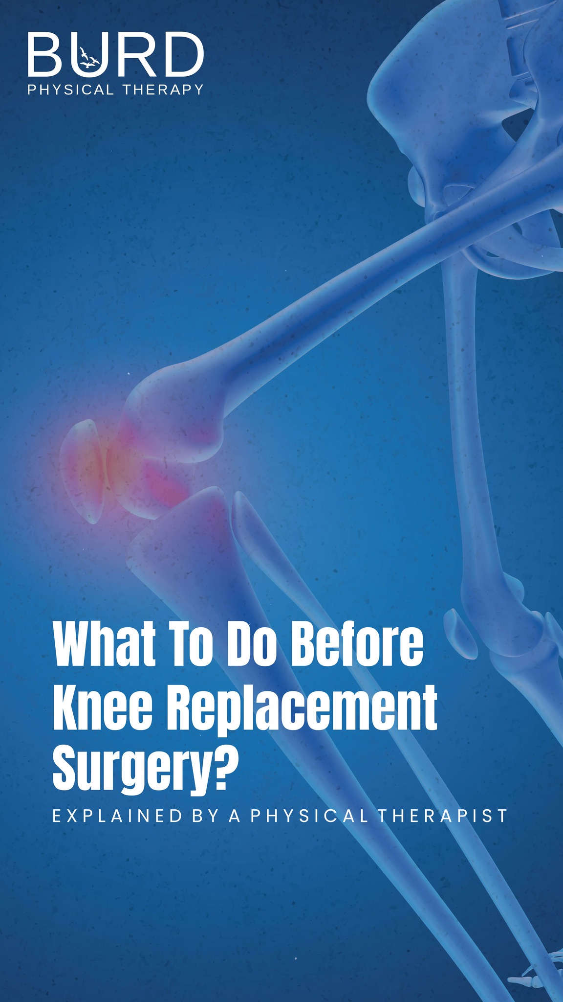 People do not realize the need to prepare your muscles before a replacement surgery. While we work with post-surgery recovery patients, we also help our patients going into surgery to work their muscles so that the knee replacement or hip replacement re-hab is smoother.