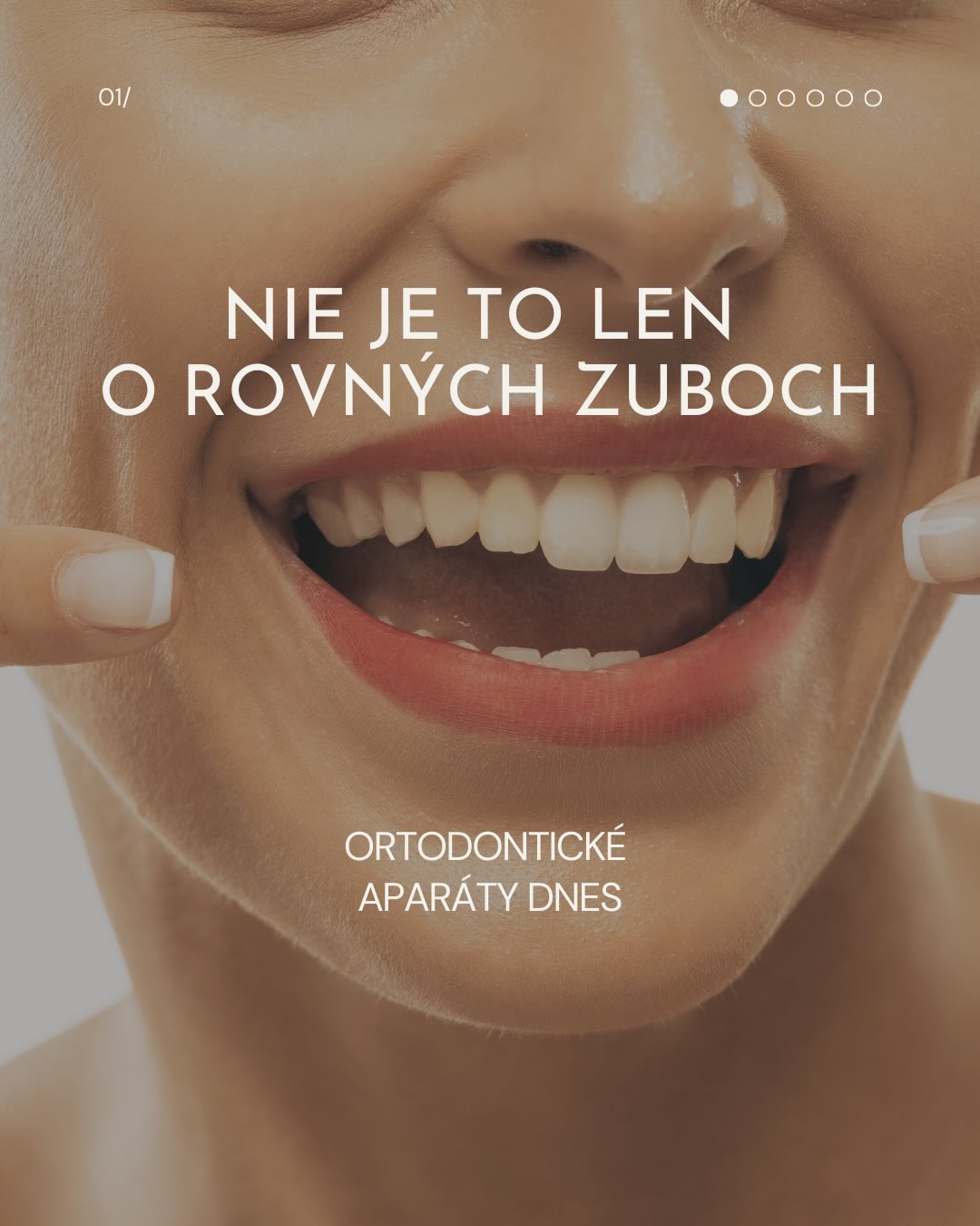 Ortodontický aparát („strojček“) nie je len o rovných zuboch. 🦷✨
V praxi riešime aj to, aby chrup fungoval:
✔ zuby správne zapadali („skus“)
✔ dali sa dobre čistiť
✔ nepreťažovali sa jednotlivé zuby ani čeľustné kĺby
✔ a aby výsledok vydržal roky
A jedna z najdôležitejších častí liečby? Retencia („retainer“) – udržiavanie výsledku. Bez nej sa zuby môžu časom posúvať späť.
➡️ Ak chcete vedieť, čo je vhodné pre vás alebo vaše dieťa, objednajte sa na ortodontické vyšetrenie.
📞 0911 212 124 alebo ONLINE NA WEBE
🛜www.drmandicakova.sk
#ortodoncia #strojcek #rovnezuby #kosice #drmandicakova