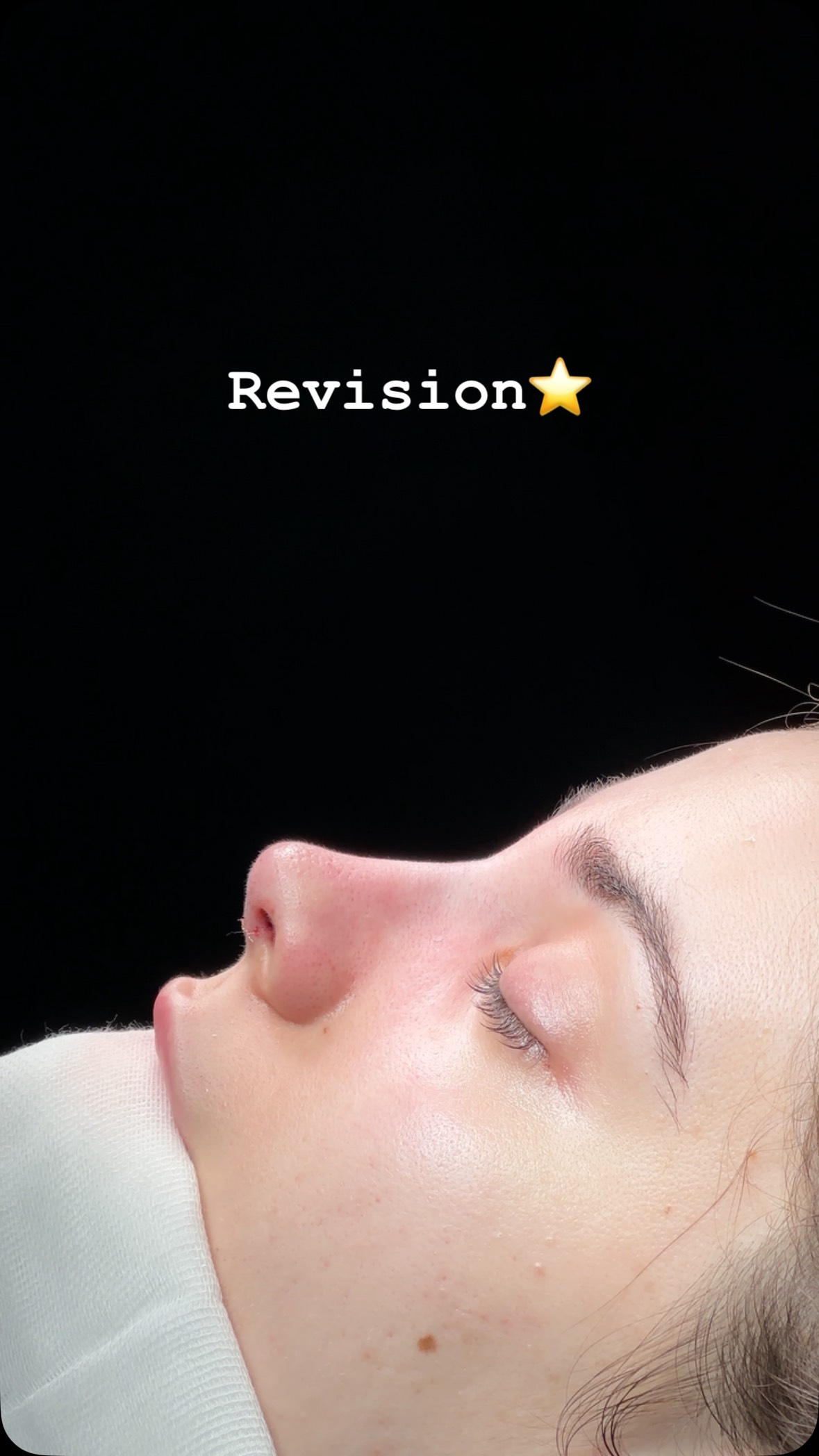 Revision from 🇦🇺