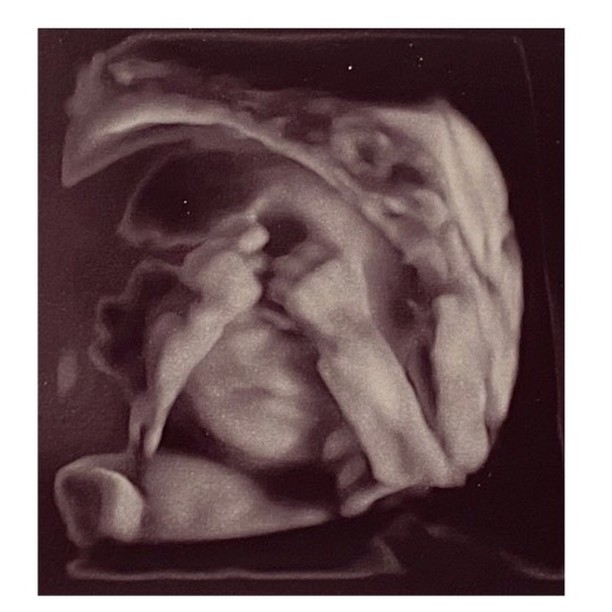 No photos please…