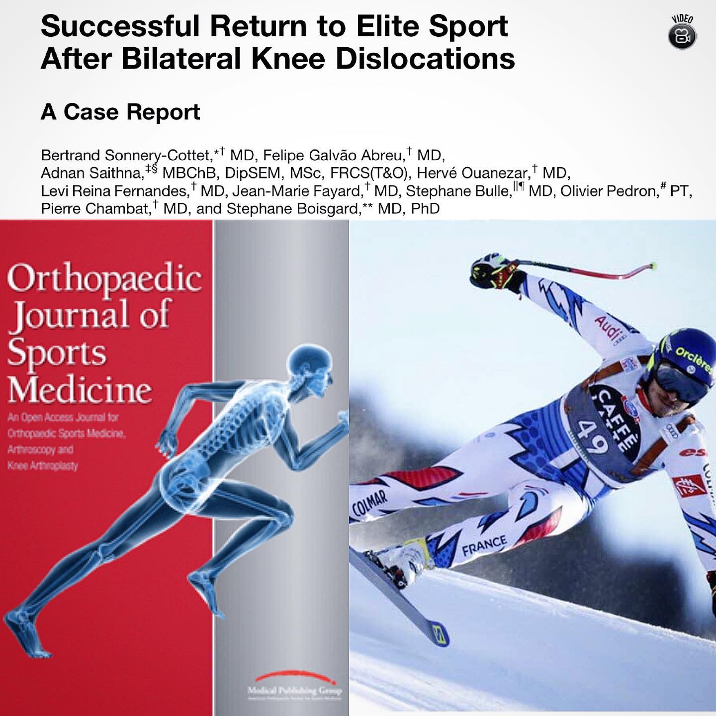 What a great champion! Fantastic team work that allowed this Elite Athlete (and amazing man) to get back on the slopes in World Cup series 💪💪 #santigroup #kneesurgery #rts