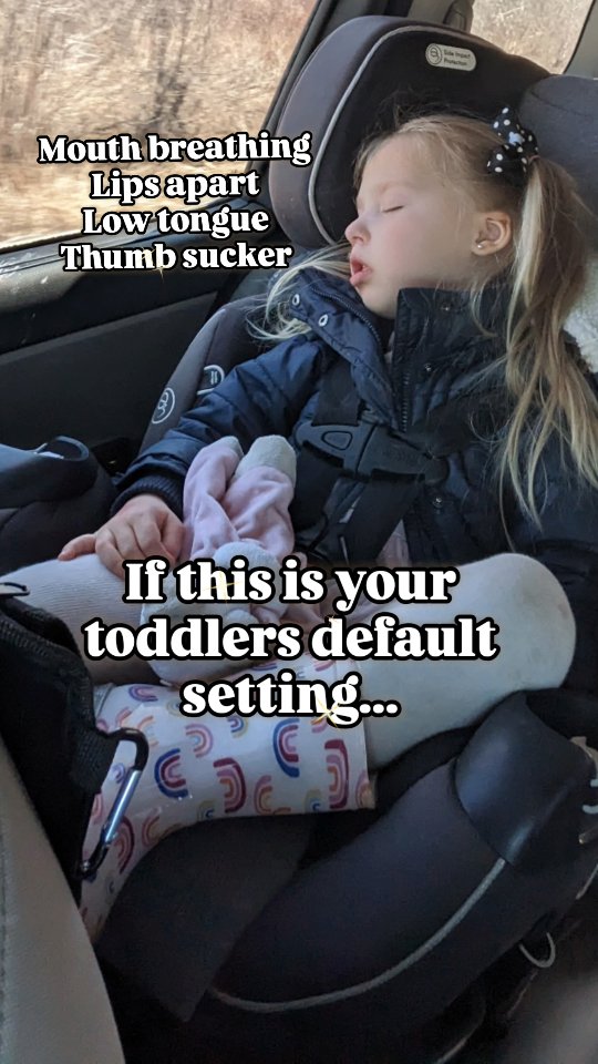 🙅♀️It's not random.
It's form following function.
The jaw doesn’t grow based on genetics alone.
It grows based on the forces applied to it — thousands of times a day.
When a thumb rests between the teeth:
• it changes tongue posture
• it alters lip seal
• it shifts pressure on the developing jaw
• it can redirect how the upper and lower jaws grow
Over time, the bones adapt to the habit.
Because growing faces are incredibly responsive.
And this isn’t about blame, shame, or guilt!
It’s about understanding that habits shape structure.
The good news? Growth is still happening — which means we can guide it in a healthier direction when we step in early.
If you’re in Ontario and noticing thumb sucking, mouth breathing, restless sleep, or bite changes… don’t just “wait and see.”
Comment 💬 HELP below and let us guide you 🫶👇
#ontariomoms #myofunctionaltherapy #rdh #SimcoeCounty #barriemoms