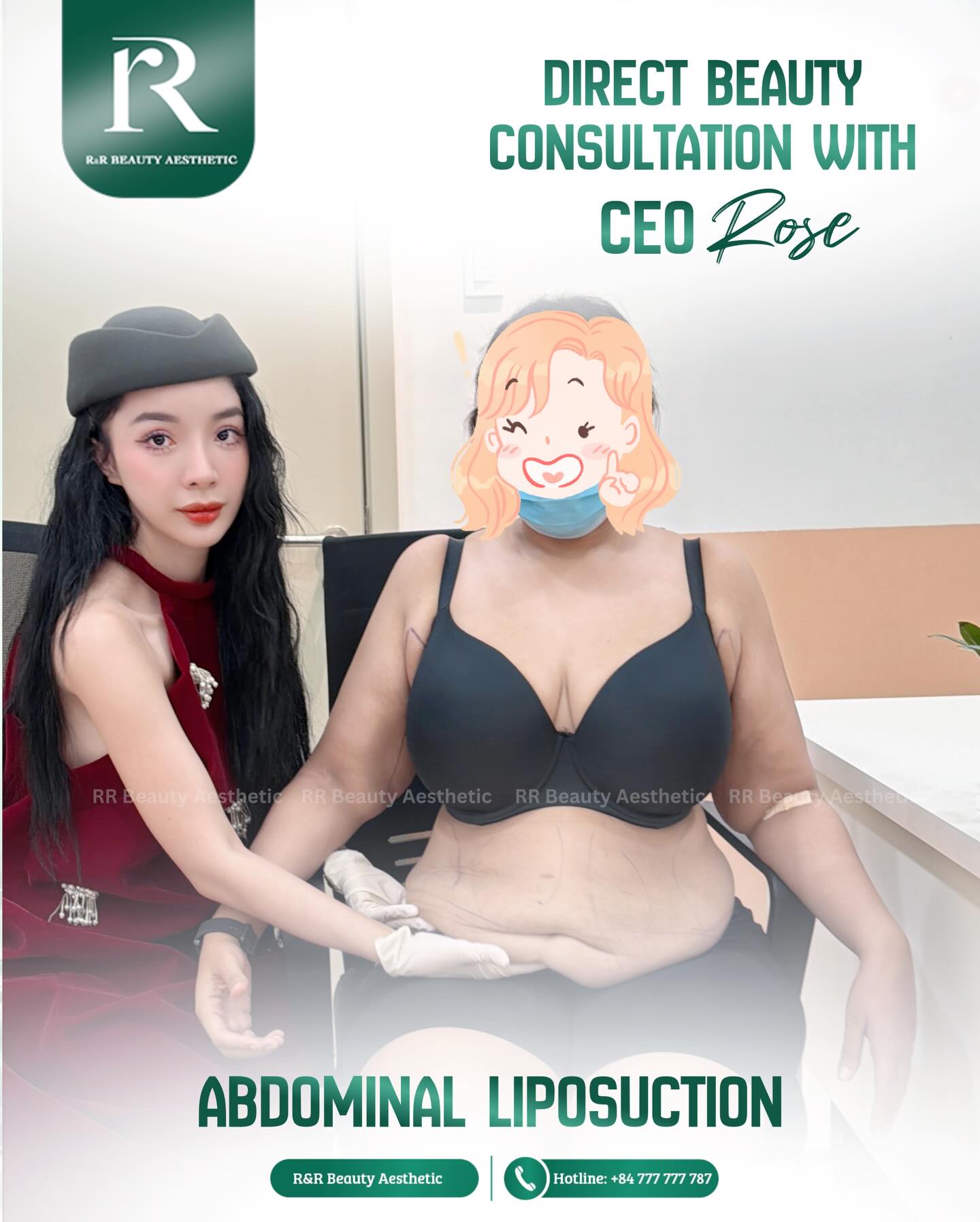 ✨ Abdominal Liposuction
Redefine Your Waist. Restore Your Confidence.
Under the direct consultation of CEO Rose, each abdominal liposuction plan is carefully designed to sculpt natural curves while maintaining balance and safety.
✔ Target stubborn belly fat
✔ Sculpt a slimmer waistline
✔ Improve body proportions
✔ Boost confidence instantly
✔ Personalized treatment plan
💬 Book your private consultation with CEO Rose today.
📞 Hotline: +84 777 777 787
.
.
.
#abdominalliposuction #liposuction #bellyfatremoval #bodysculpting #waistcontouring fatremoval aestheticclinic bodytransformation confidenceboost noninvasivesculpt
abdominal liposuction near me
belly fat removal treatment
best liposuction clinic
body contouring procedure
fat removal surgery consultation
waist slimming treatment
stubborn belly fat solution
liposuction before after
safe liposuction procedure
private aesthetic consultation