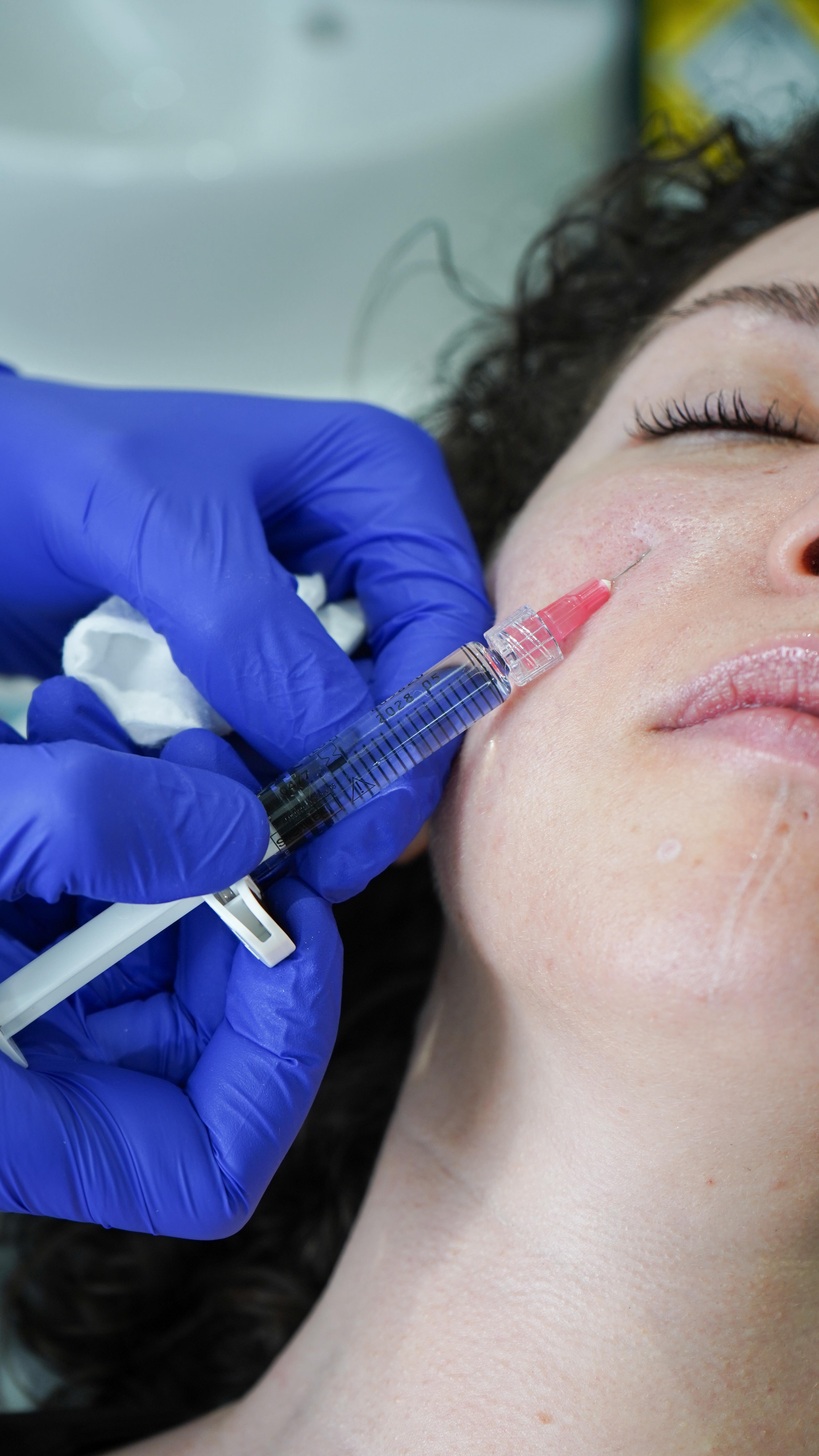 Collagen production starts declining in your late 20s⌛️
Profhilo helps stimulate it again by improving elasticity, hydration and firmness without changing your face✨
💡The earlier you start stimulating collagen,
the less you’ll need to correct later
No change in shape. Just better skin quality❤️
Choosing between Profhilo and filler isn’t about trends.
It’s about assessment👩🏼⚕️
Book your personalised consultation via the link in bio🔗
@profhilo_uk_ireland #skinboosters #profhilo® #skin