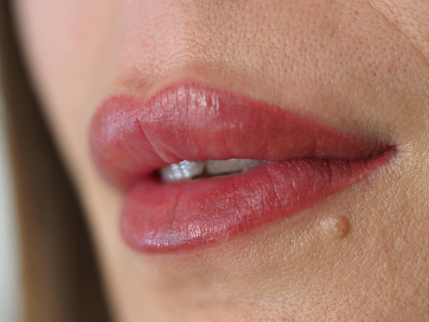 Maquillage permanent des lèvres 👄
Ce maquillage permanent sublime les lèvres en leur apportant une couleur fraîche, homogène et délicatement rosée. Le contour est parfaitement redessiné tout en restant fondu, pour un rendu naturel sans effet crayon marqué.
La teinte choisie ravive la pigmentation naturelle des lèvres, corrige les petites irrégularités et apporte un effet légèrement repulpé grâce à un dégradé subtil.
Le résultat :
✔️ Des lèvres visiblement plus définies
✔️ Une couleur uniforme et éclatante
✔️ Un effet bonne mine immédiat
✔️ Un gain de temps au quotidien
La technique permet d’intensifier la couleur tout en respectant la morphologie et l’harmonie du visage, pour un résultat élégant et durable.