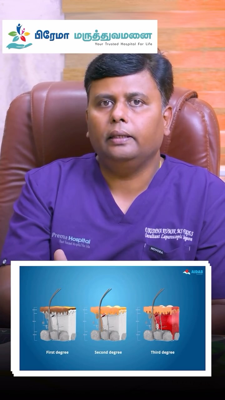 🔥 Burn Injury Stages – Know the Severity & Act Fast 🔥
Burns are classified into 4 stages based on how deeply the skin is damaged. Identifying the stage quickly helps in giving the right treatment and preventing complications. 🏥 Advanced Burn Care at Prema Hospital – Coimbatore
✨ 24×7 Emergency & Trauma Services
🧑⚕️ Expert Burn & Wound Care Specialists
🛏️ Advanced ICU & Pediatric Care
🩹 Safe Dressing & Infection Control
⚡ Quick Response to Prevent Complications
📍 Kaniyur, Coimbatore
📞 Call Now: +91 99445 59000
🌐 www.premahospital.com
💡 Early treatment reduces infection, prevents scarring & saves lives.
#BurnAwareness #FireSafetyTips #EmergencyCare #ChildSafetyFirst #PremaHospital