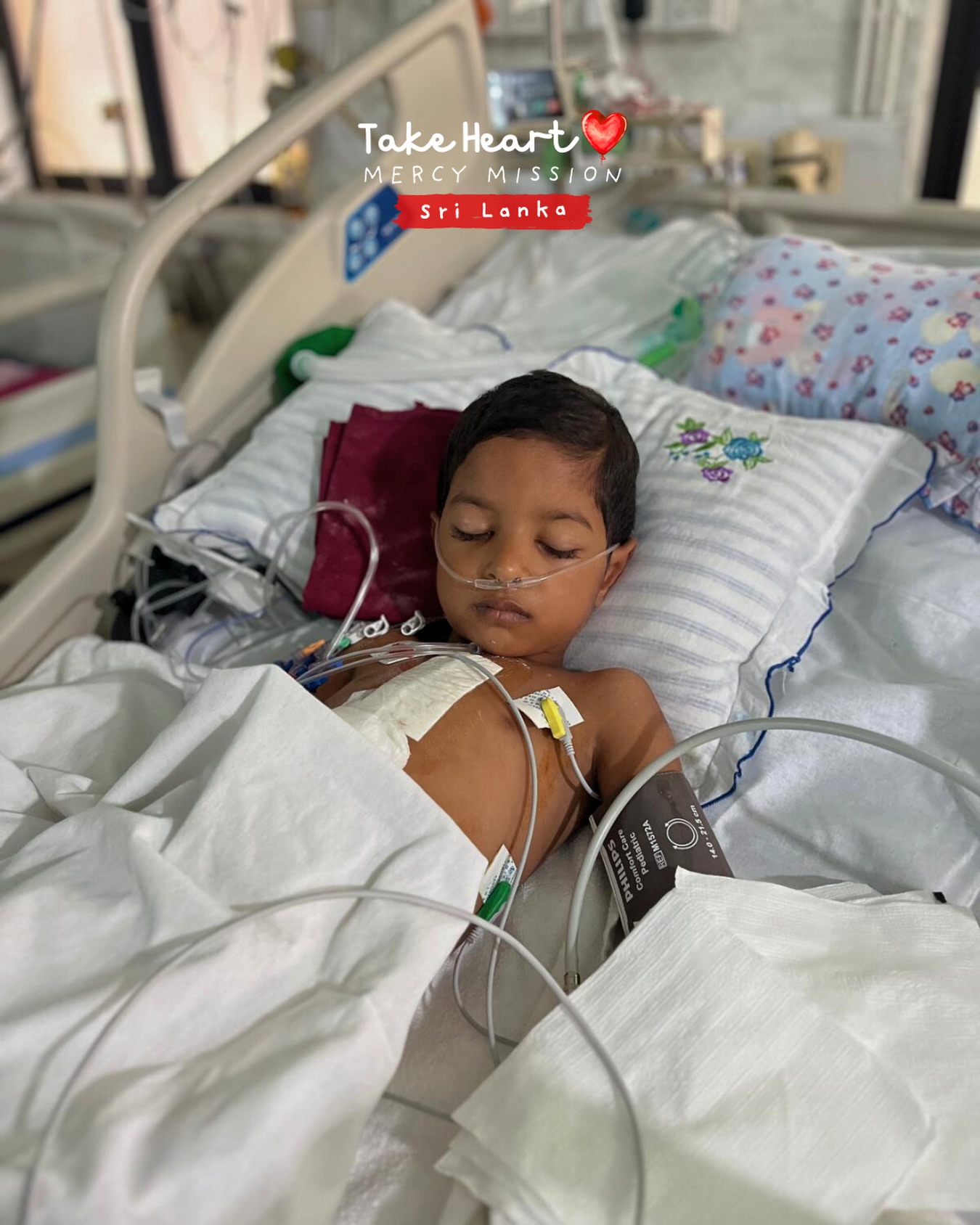 One small heart, resting after a big operation. Moments like this remind us why every surgery matters and why every bit of support counts.
If you’re able to, please consider helping us give more children the chance to rest, recover, and grow strong.
👉 Donate via the link in our bio.
#takeheartmercymission #savinglittlehearts #srilanka #heartsurgery #lifesavingcare
