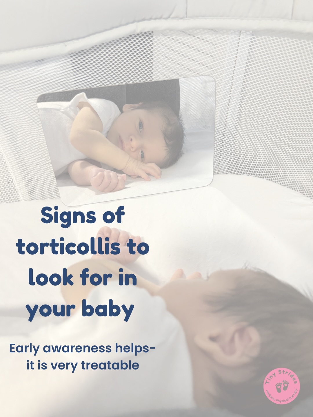 Noticing your baby looks one way more than the other? That’s actually very common.
But if you’re noticing a strong preference, a head tilt, or a developing flat spot, it may be worth a closer look.
The good news: torticollis is common and responds very well to early, gentle intervention.
If you’re in the Cleveland area and have questions, I’m always happy to help!
Save this post for later or share with a new parent who might need it.
#clevelandmom #clevelandparents #babymilestone #torticollis #plagiocephaly