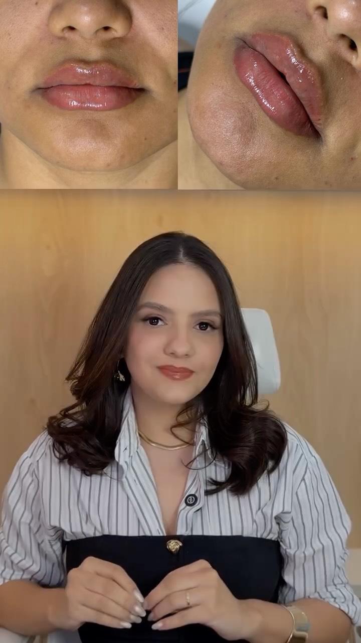 Você pode ser minha MODELO e ter esse resultado lindoooo por um valor muito bom, porque modelos tem condição especial de preço e pagamento! 💋✨
Se você tem interesse em saber mais, comenta aqui “EU QUERO” e vamos entrar em contato com você 😍
#estetica