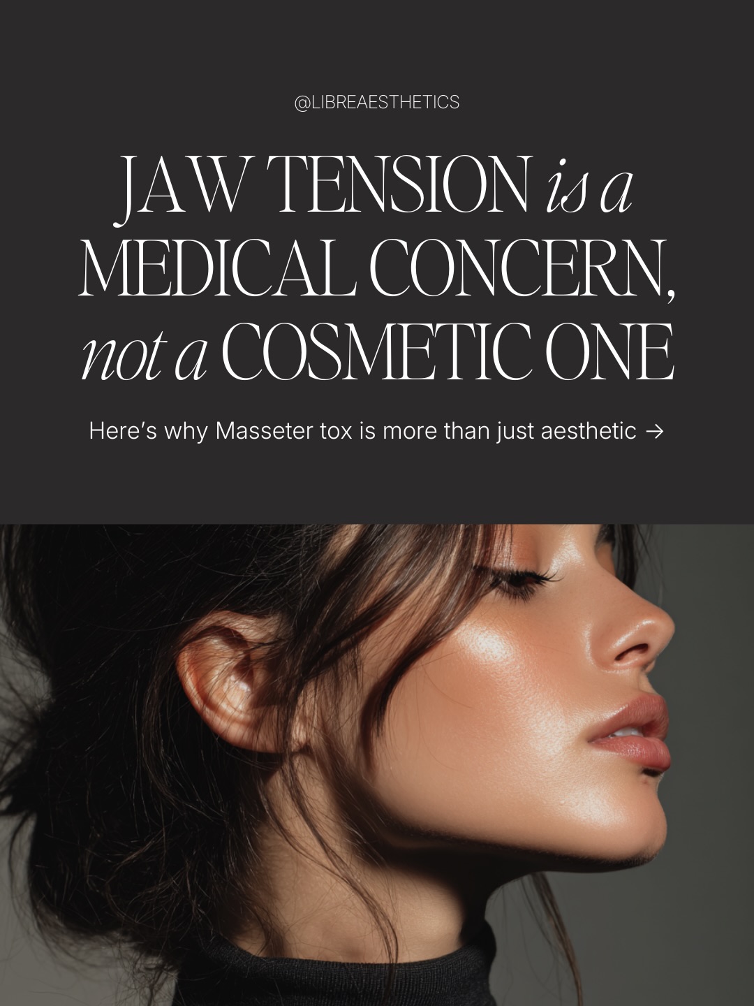 It’s not just for a snatched jawline. It’s for relief.
Masseter Tox: the treatment that’s more than just aesthetic.
For those who clench, grind, or wake up with tension this treatment can help soften the muscle, ease discomfort, and yes… refine the lower face.
Less tension.
Fewer headaches.
A more balanced profile.
Beauty is great. Comfort is better. 🤍
#wheaton #naperville #wheatonbotox #napervillebotox #wheatonmedspa