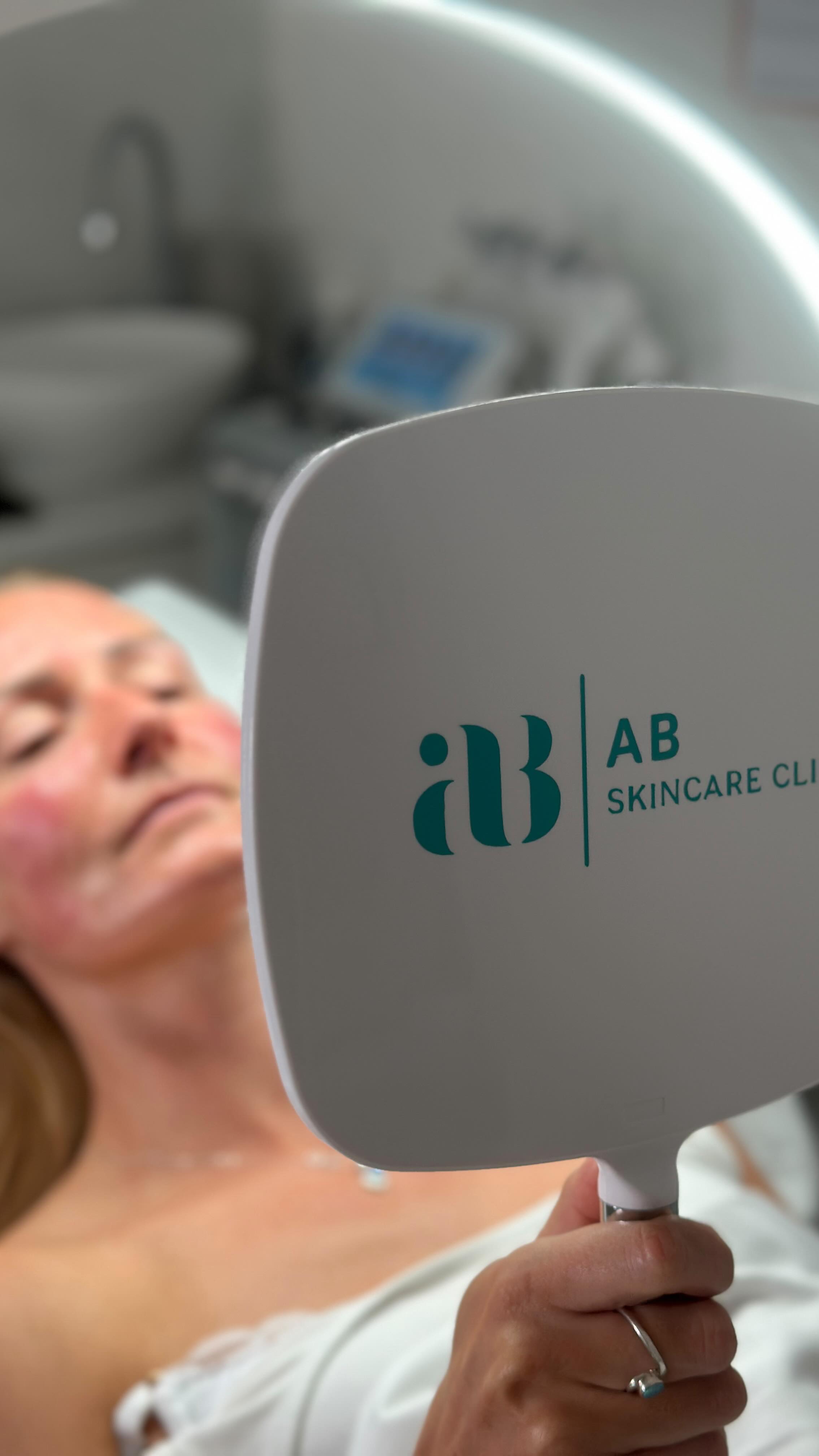 Understanding Polyneucleotides ✨
Have you noticed those tiny blebs that appear after your polyneucleotide treatment? Don’t worry—this is completely normal! Unlike fillers or Botox, we work in the intradermal layer—right beneath the surface. These little bumps form as the solution spreads and integrates, and they will settle within a few hours.
Why choose polyneucleotides? They’re packed with regenerative power! These treatments boost hydration, improve skin elasticity, and stimulate natural collagen production—helping you achieve a youthful, radiant glow.
Comment ‘INFO’ to receive more information on what makes Polynucleotides @abskincareclinic the most Elite in the South West 🏴
#SkinRejuvenationTalbotGreen #PolyneucleotidesPontyclun #EliteFacialTreatmentsSouthWales #Anti-AgingCardiff #MesotherapyPontyclun