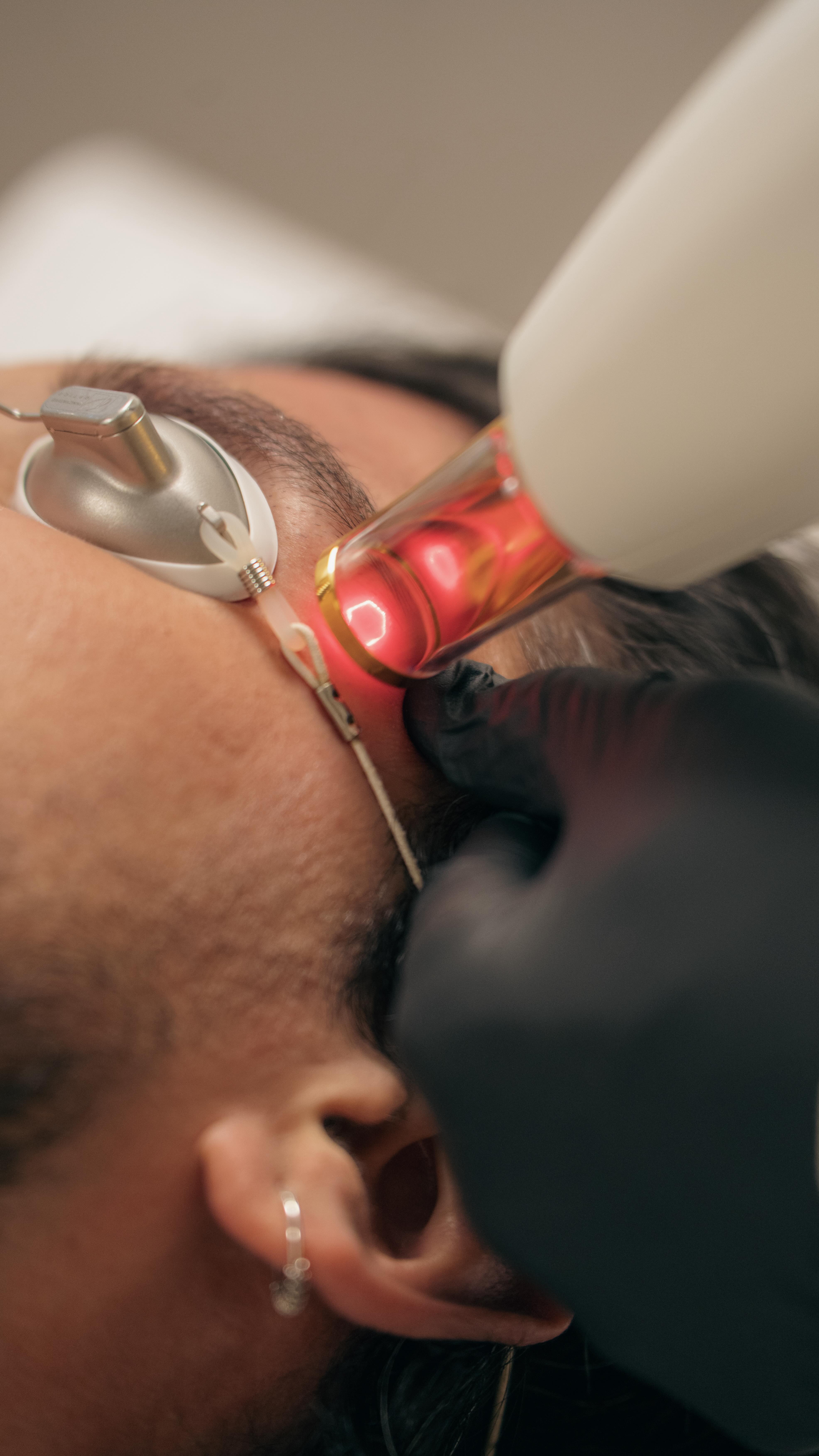 Narben und Pigment Behandlung perfekt abgestimmt bei Dermedesthetic.
•
Scar and pigmentation treatment perfectly tailored at Dermedesthetic
•
#medicalscare #antipigment