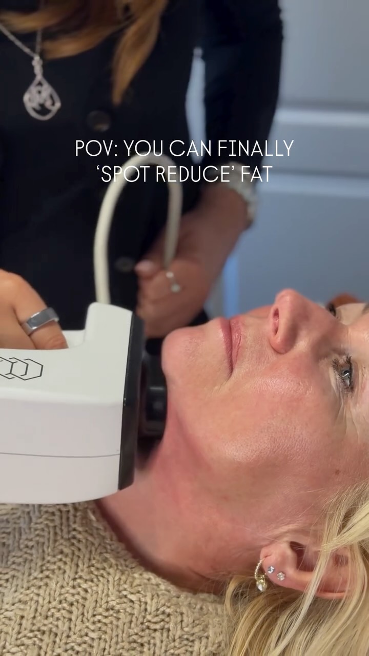 You can’t spot reduce fat through exercise alone.
But you can target specific areas with the right technology.
Body FX and Mini FX are designed to treat stubborn fat deposits that don’t respond to diet and training. Using controlled energy and vacuum technology, we break down fat cells while tightening the skin at the same time.
Mini FX is ideal for:
Double chin
Jawline
Small facial pockets
Body FX is ideal for:
Lower stomach
Flanks
Thighs
Bra line
Stubborn body areas
This isn’t weight loss.
It’s targeted contouring.
If you’re fit, eating well, and still frustrated by one area - this is where we step in.
Free consultations available to check suitability.
#cheltenham #salon #gloucestershire #cheltenhambeauty #fatloss targerted fat loss