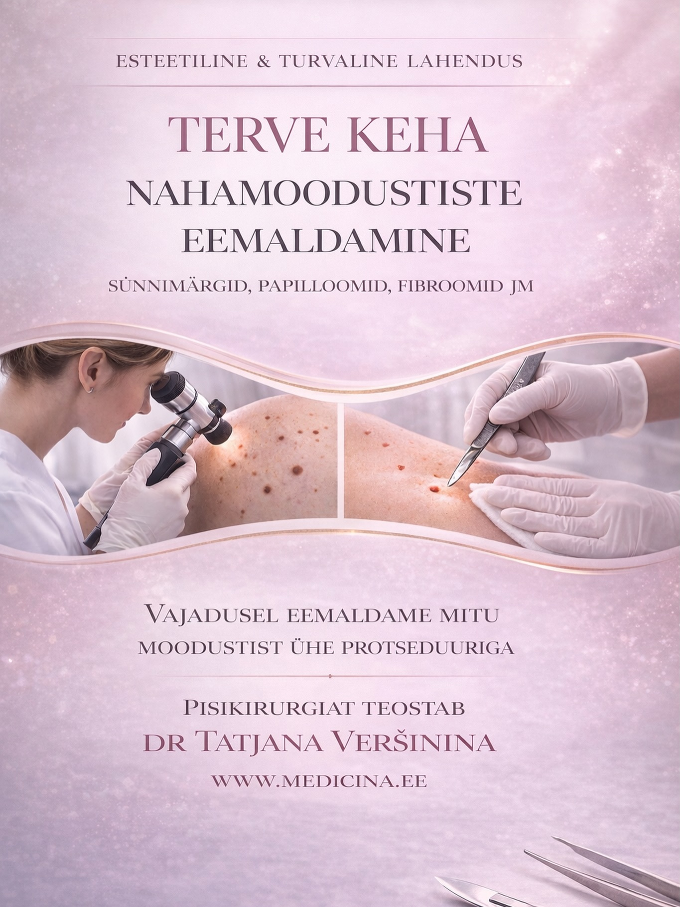 NAHAMOODUSTISTE EEMALDAMINE KEHAL
Kas kehal on sünnimärke, papilloome või fibroome vm@moodustisi, mis häirivad või vajavad kontrolli?
Medicina kliinikus teostame nahamoodustiste eemaldamist ühe valikuna pisikirurgia meetodil, turvaliselt ja professionaalselt. Protseduurile eelneb alati põhjalik konsultatsioon arstiga.
- Vajadusel eemaldame mitu moodustist ühe protseduuriga
- Individuaalne lähenemine igale patsiendile
- Vajadusel tsüto-histoloogiline uuring
👩⚕️ Pisikirurgiat teostab dr Tatjana Veršinina
Broneeri konsultatsioon ja saa professionaalne hinnang oma nahamoodustistele.
de Veršinina nõustab patsiente eesti, vene ja inglise keeles.
www.medicina.ee
#nahamoodustised #sünnimärgid
#papilloomid #fibroomid #pisikirurgia
__________
УДАЛЕНИЕ КОЖНЫХ ОБРАЗОВАНИЙ НА ТЕЛЕ
Есть ли на теле родинки, папилломы, фибромы или другие образования, которые беспокоят или требуют проверки?
В клинике Medicina мы выполняем удаление кожных образований методом малой хирургии, безопасно и профессионально. Перед процедурой всегда проводится подробная консультация врача.
• При необходимости удаляем несколько образований за одну процедуру
• Индивидуальный подход к каждому пациенту
• При необходимости проводится гистологическое исследование
👩⚕️ Малую хирургию выполняет
д-р Татьяна Вершинина
Запишитесь на консультацию и получите профессиональную оценку ваших кожных образований.
🌐 www.medicina.ee