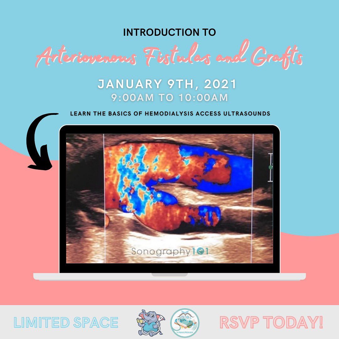 The one you’ve been waiting for - Introduction to arteriovenous fístulas and grafts 🤓
We will cover anatomy, hemodynamics and sonographic techniques needed for an optimal evaluation.
Go to www.sonography101.com/introduction-to-hemodialysis-access
to RSVP.
First 10 registrants will have lifetime access to a great course on Hemodynamics and Doppler by @ultrasoundmedacademy
All registrants will have access to the lecture recording for 15 days.
Space is limited, sign-up today!
We hope to see some of you there 🤗
.
.
.
.
#ultrasound #sonography #medicalsonography #RDMS #RVT #RegisteredDiagnosticMedicalSonographer #RegisteredVascularTechnologist #UltrasoundTechnologist #Sonographer #UltrasoundTech #Sonography101 #ultrasoundED #ultrasononography #ultrasonographer #Medicine #Medical #Radiology #Radiologia #Ultrasonido #DiagnosticImaging #Medicina #Sonograma
#sonographystudent #sonographyschool