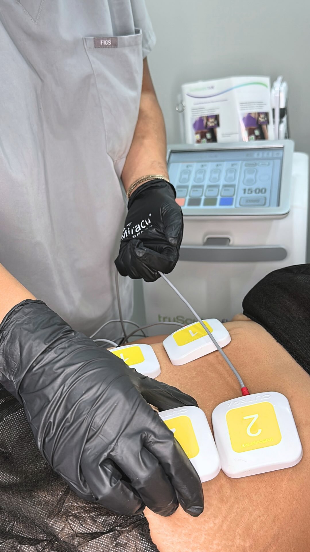 Weight loss is an incredible achievementâbut sometimes, the face tells a different story than youâd like.
When we lose weight, facial volume goes with it. The under-eyes look hollow and tired, cheeks flatten, and shadows appear around the chin that age us beyond our years. You did the work to feel healthier, but your reflection doesnât match how vibrant you actually feel.
Thatâs where facial balancing comes in. â¨
Weâre not changing your faceâweâre restoring the volume and support that creates a youthful, rested appearance:
đď¸ Under-eye support with hyaluronic acid filler (no more âyou look tiredâ)
đ Mid-face volume restoration to lift and brighten
đŤ Profile enhancement for chin definition
⨠Jawline contouring to sharpen and frame your face
This isnât about trends or âfillingâ everythingâitâs about understanding YOUR facial anatomy and strategically restoring what weight loss took away.
You worked hard for your transformation. Letâs make sure your face reflects the vibrant, confident person you are.
Comment âBALANCEâ to learn which areas would benefit you most. đ
#facialbalancing #weightlosstransformation #honolulumedspa #rejuvehonolulu #facialanatomŃ